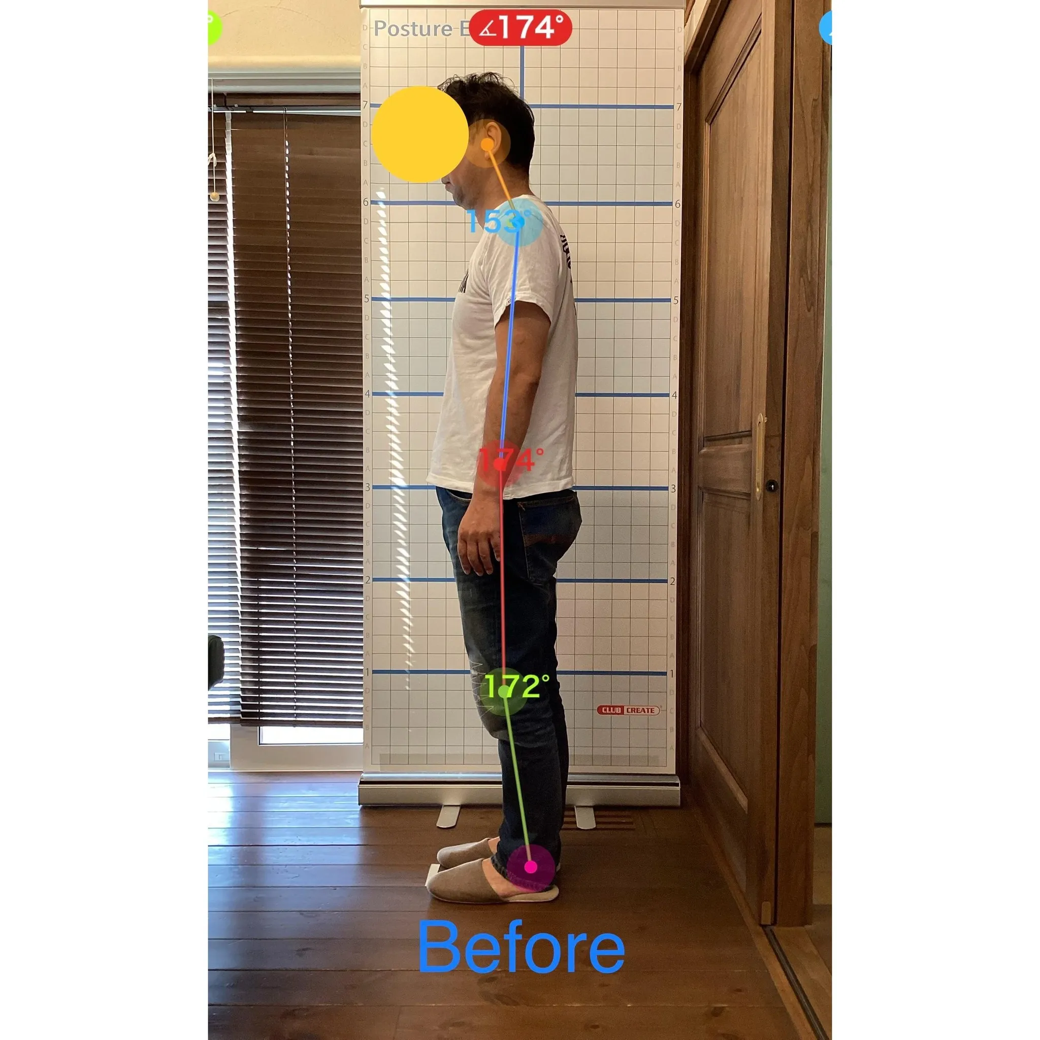 【富里 整体】ギックリ腰、肩こり、猫背 他/50代男性/職業...