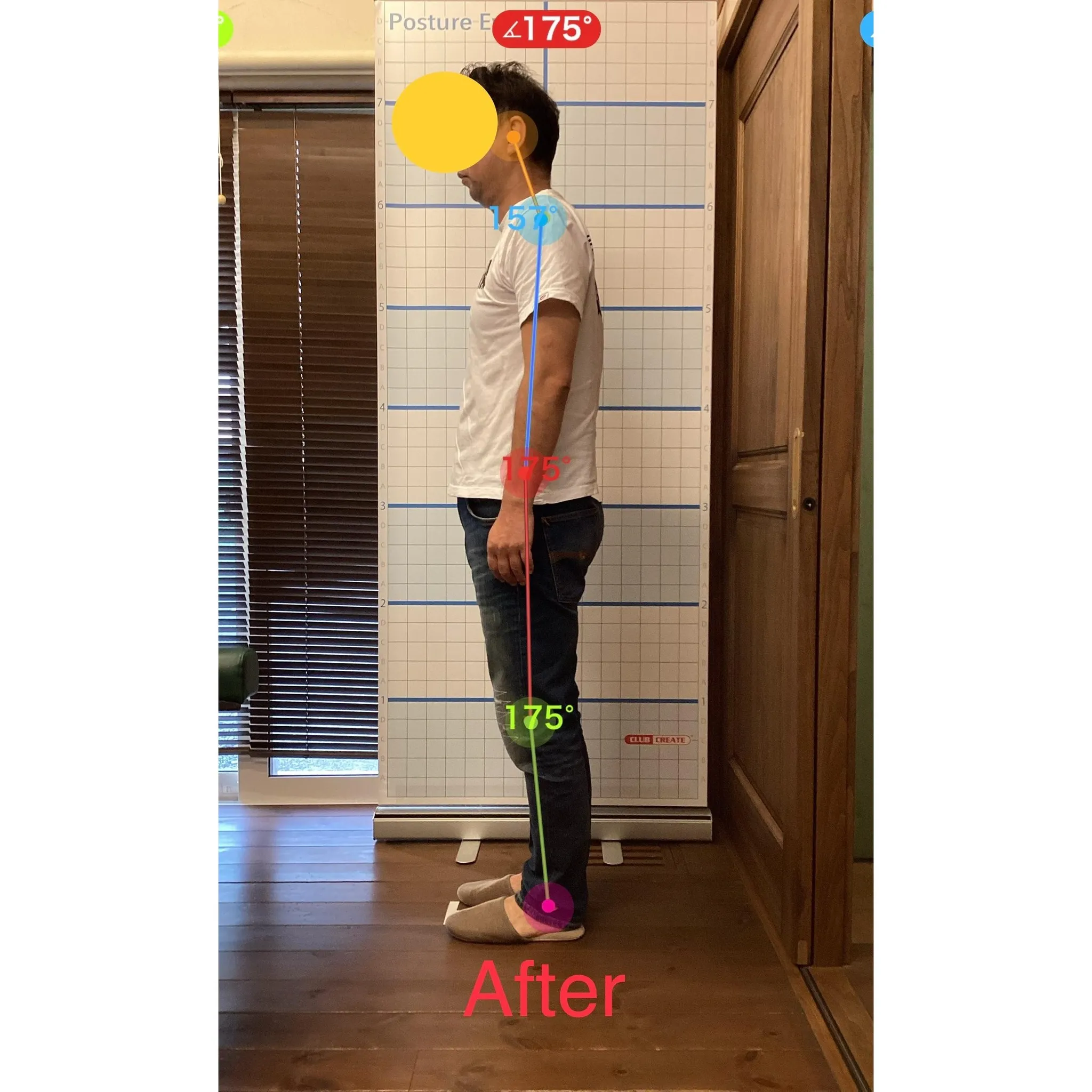 【富里 整体】ギックリ腰、肩こり、猫背 他/50代男性/職業...