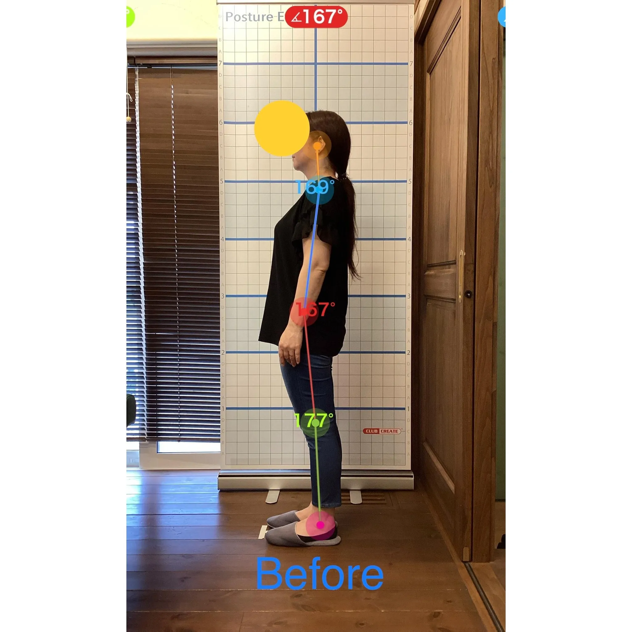 【富里 整体】坐骨神経痛、首のコリ、腰痛 他/40代女性/立...