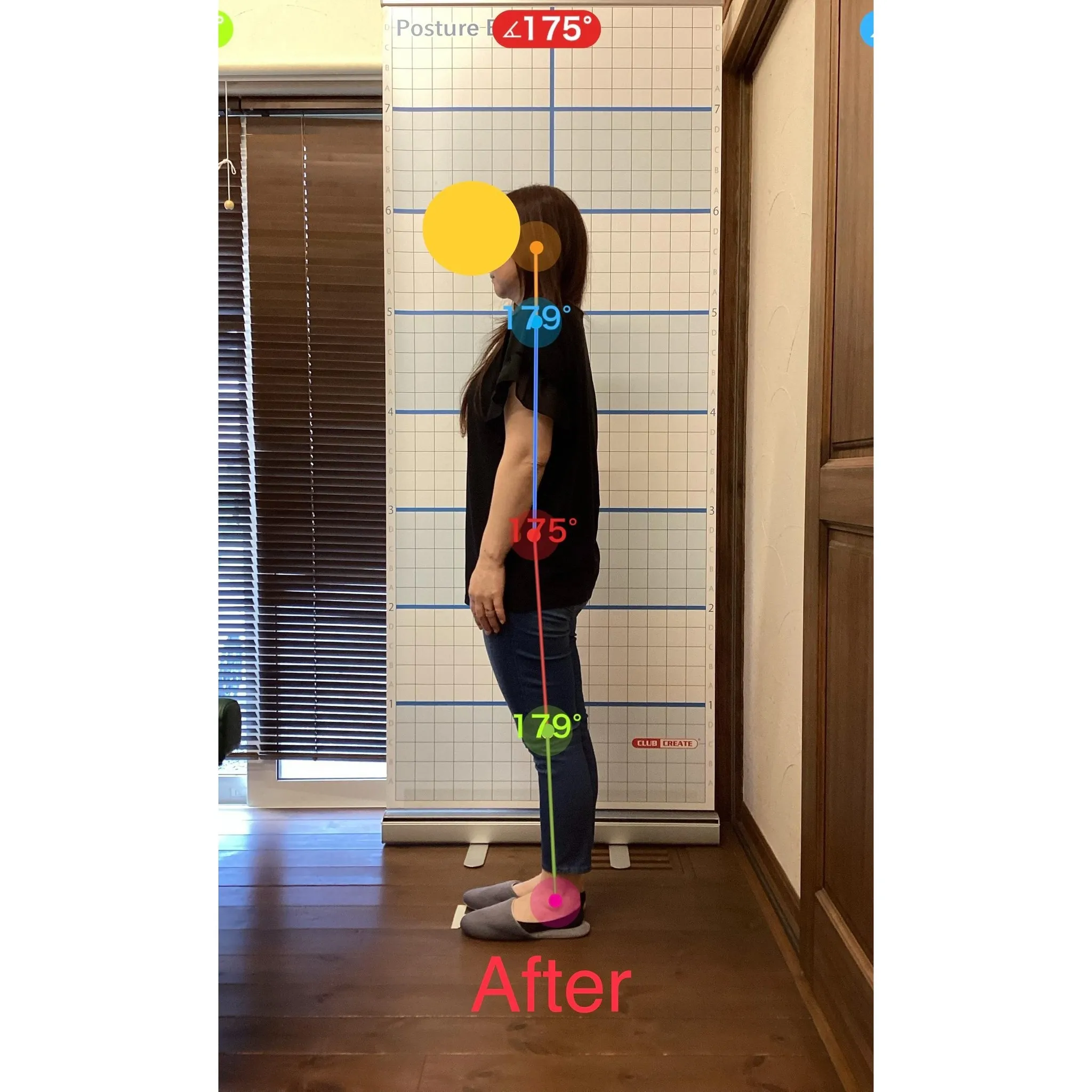 【富里 整体】坐骨神経痛、首のコリ、腰痛 他/40代女性/立...