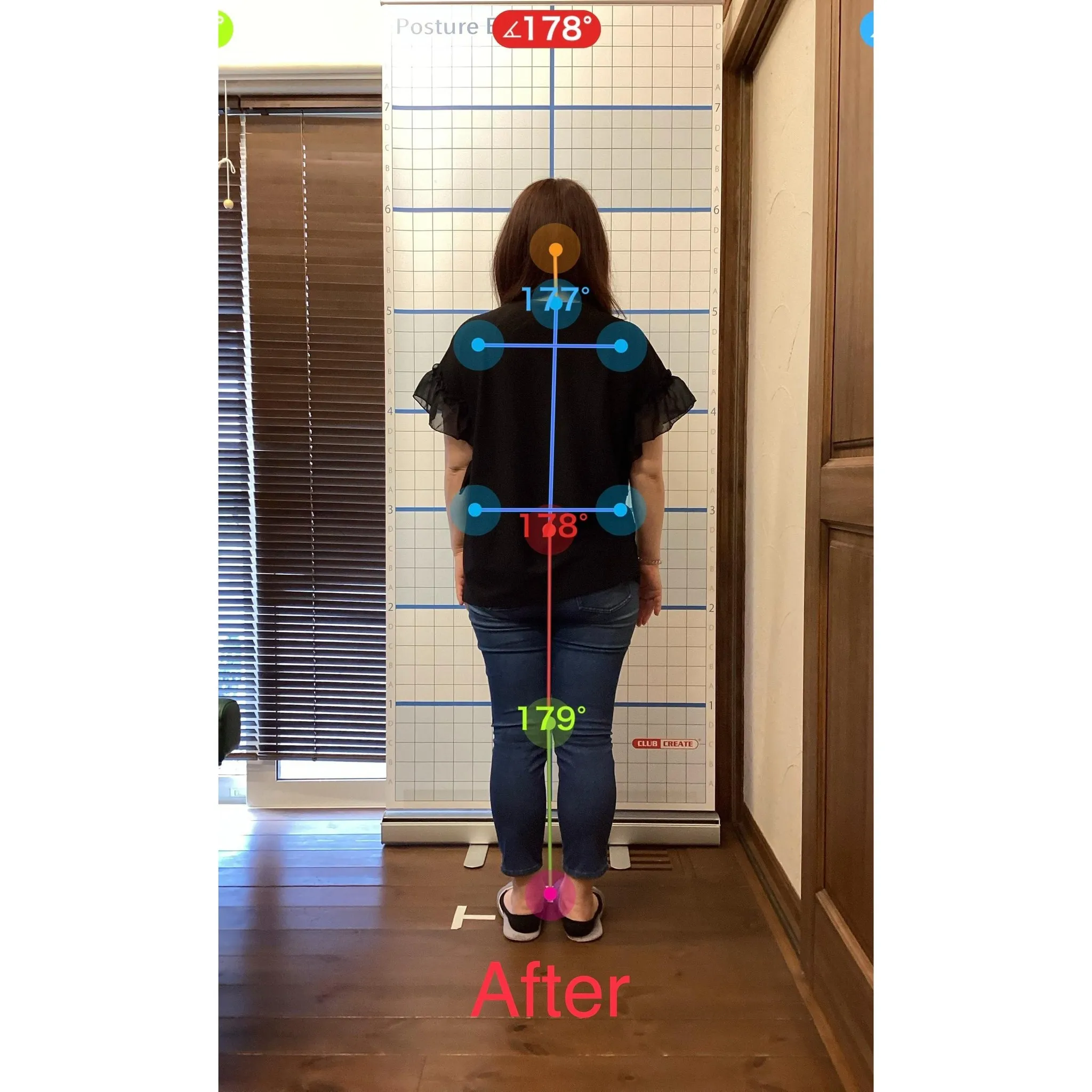 【富里 整体】坐骨神経痛、首のコリ、腰痛 他/40代女性/立...