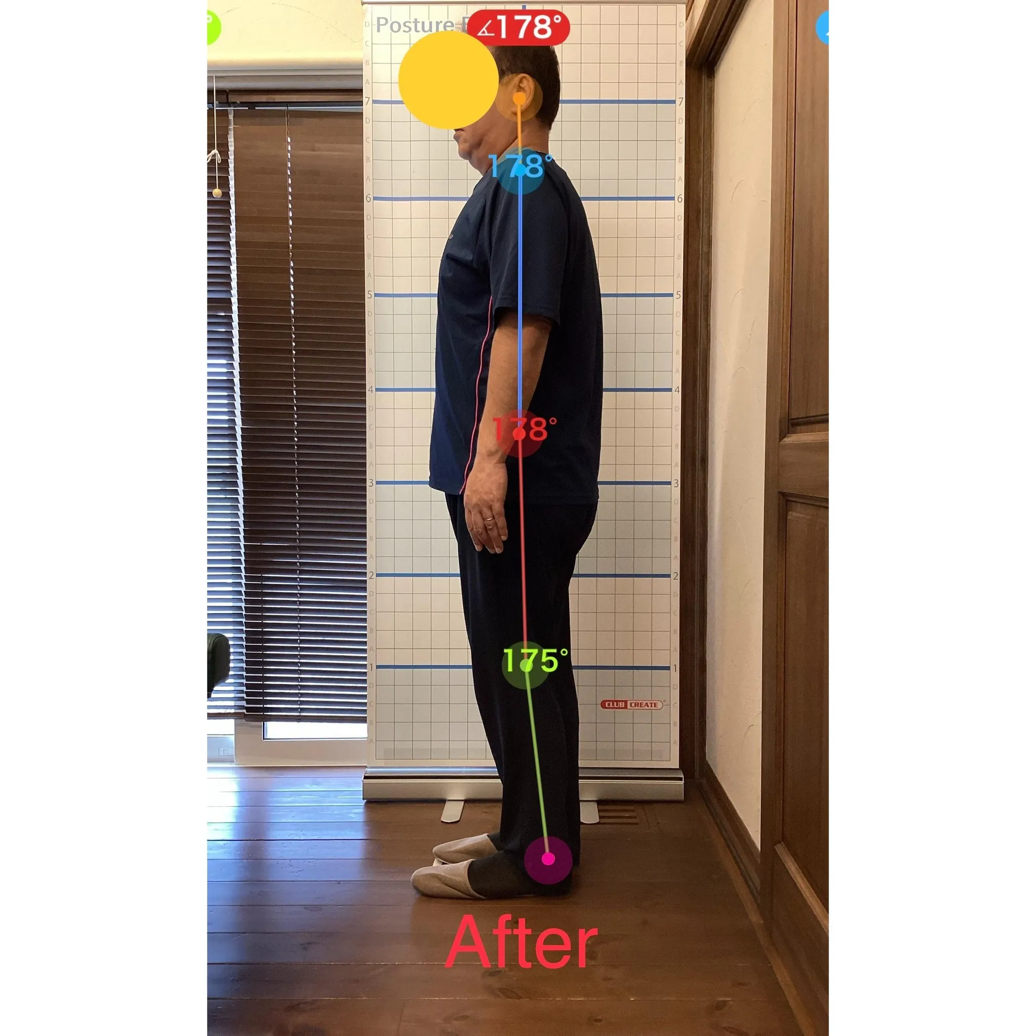 【富里 整体】腰痛、肩こり、背中の痛み 他/50代男性/会社...