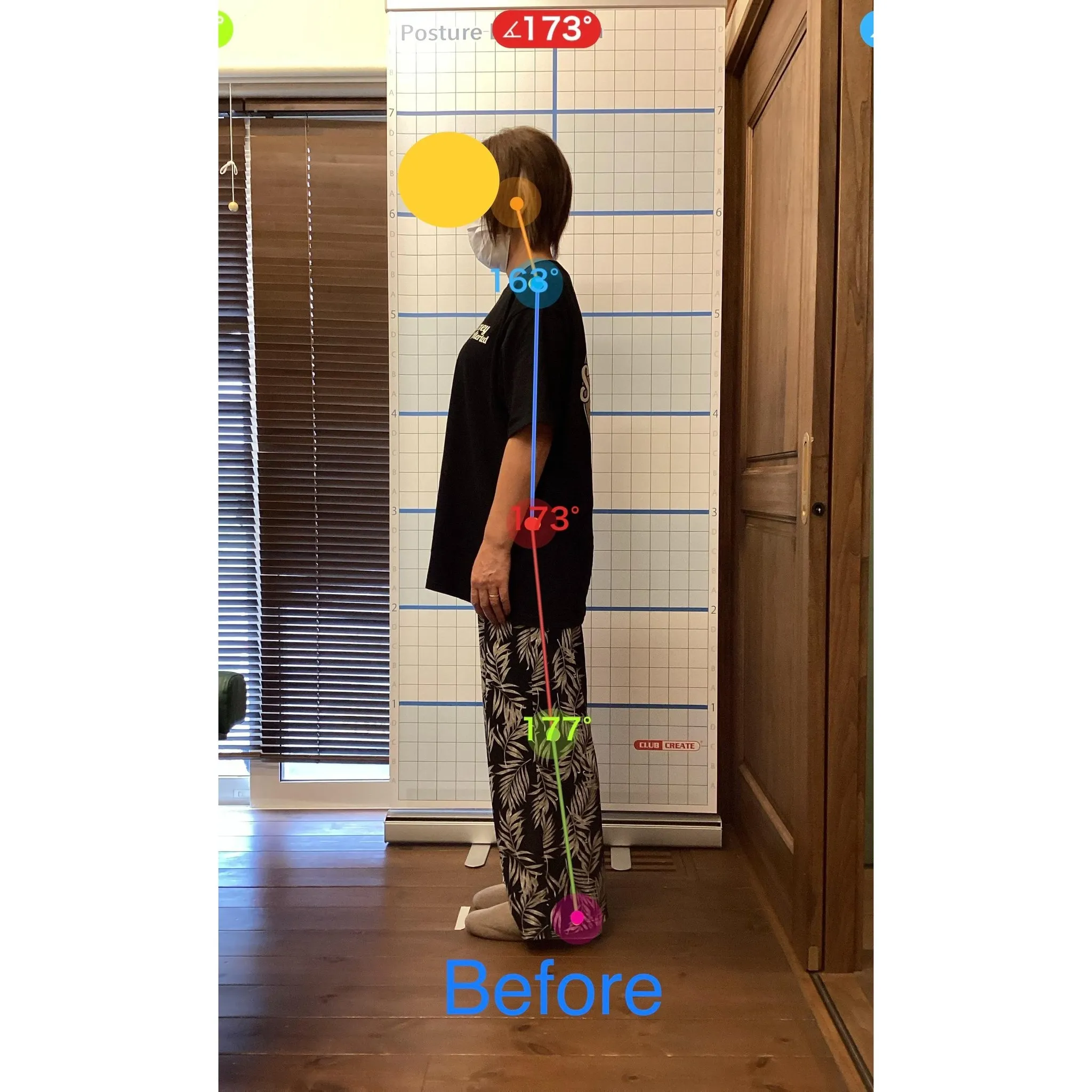 【富里 整体】腰痛、鎖骨の痛み、肩こり 他/50代女性/職業...