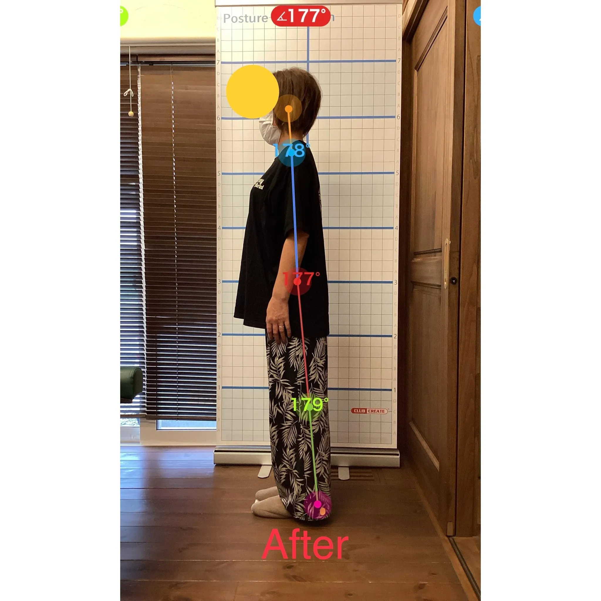 【富里 整体】腰痛、鎖骨の痛み、肩こり 他/50代女性/職業...