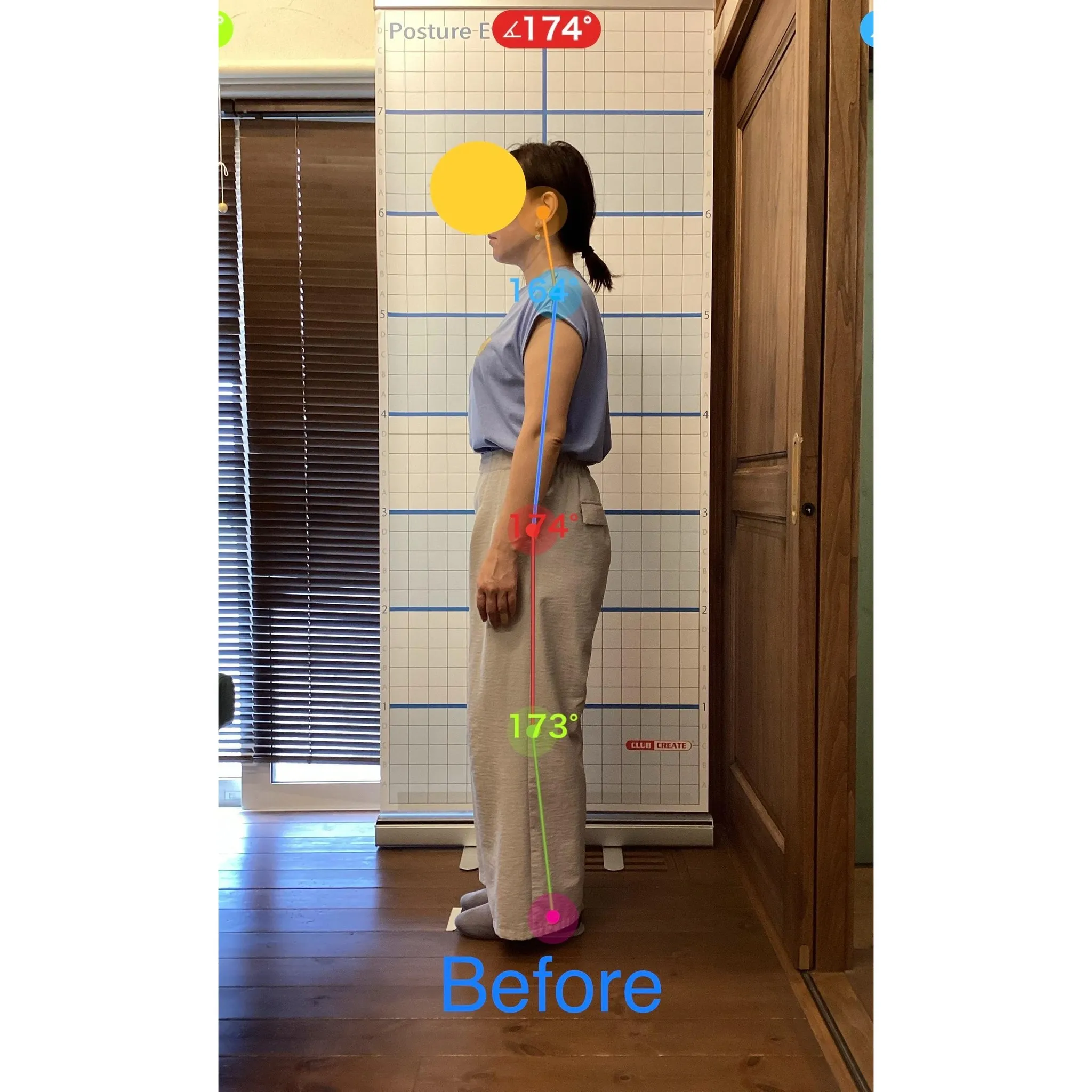 【富里 整体】内腿の痛み、腕の痛み(テニス肘)/40代女性/...