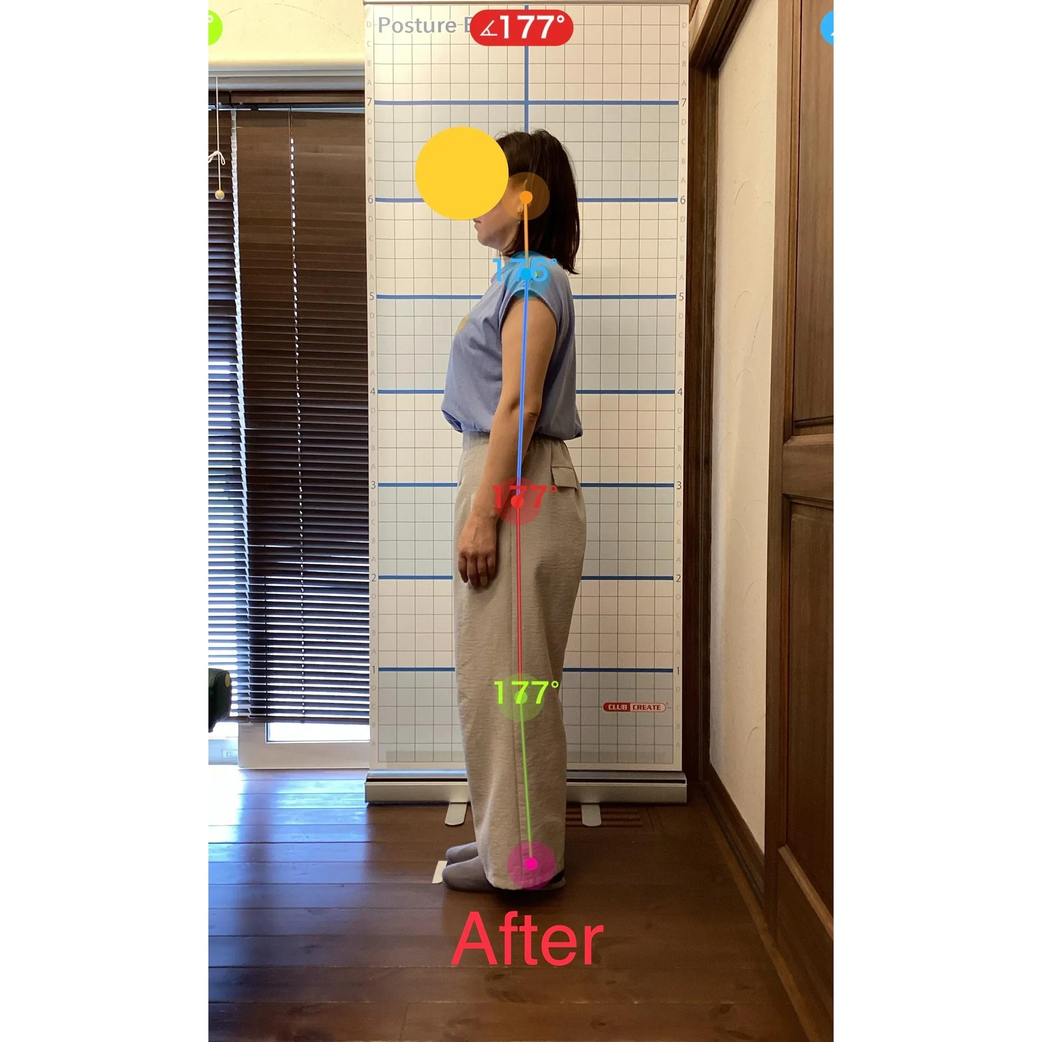 【富里 整体】内腿の痛み、腕の痛み(テニス肘)/40代女性/...