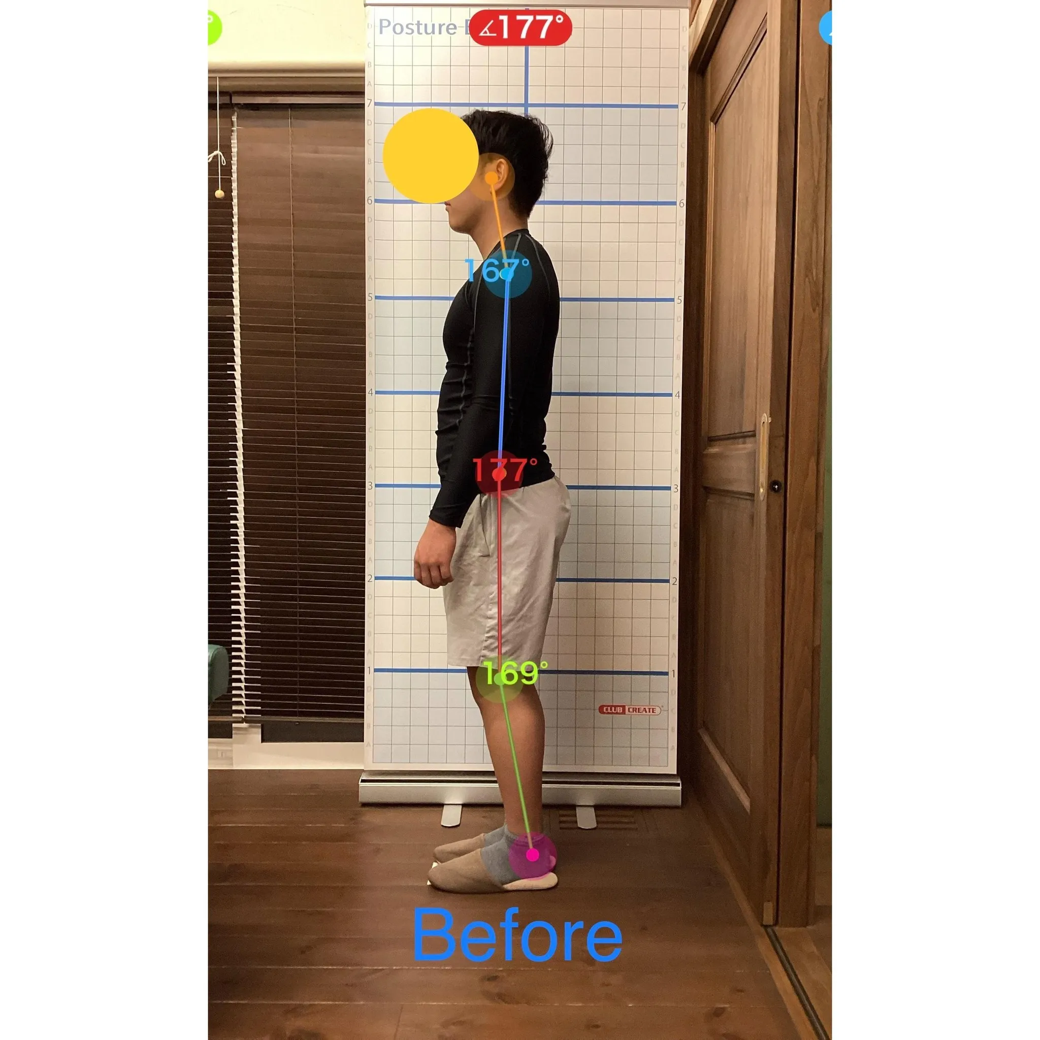 【富里 整体】首の痛み、頭痛、足底筋膜炎 他/20代男性/消...