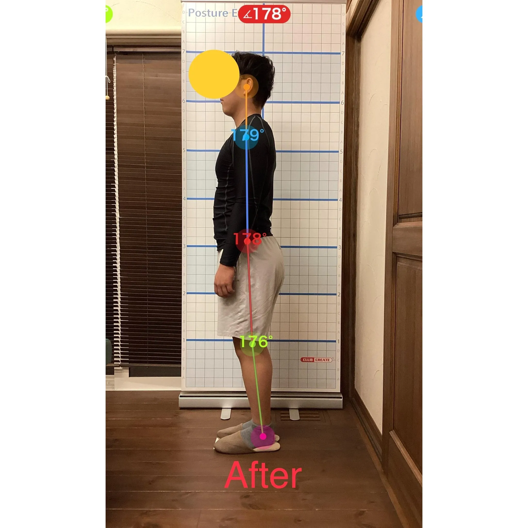 【富里 整体】首の痛み、頭痛、足底筋膜炎 他/20代男性/消...