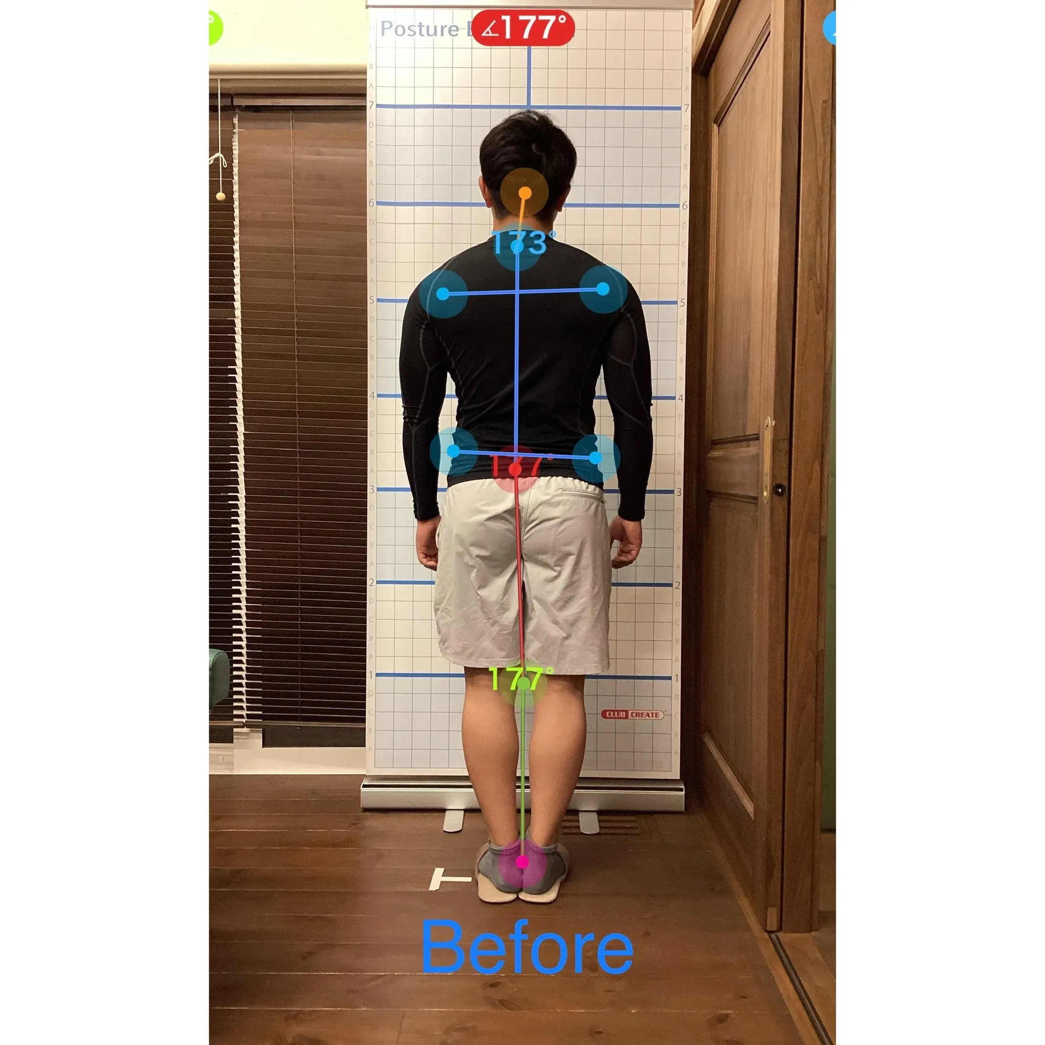 【富里 整体】首の痛み、頭痛、足底筋膜炎 他/20代男性/消...