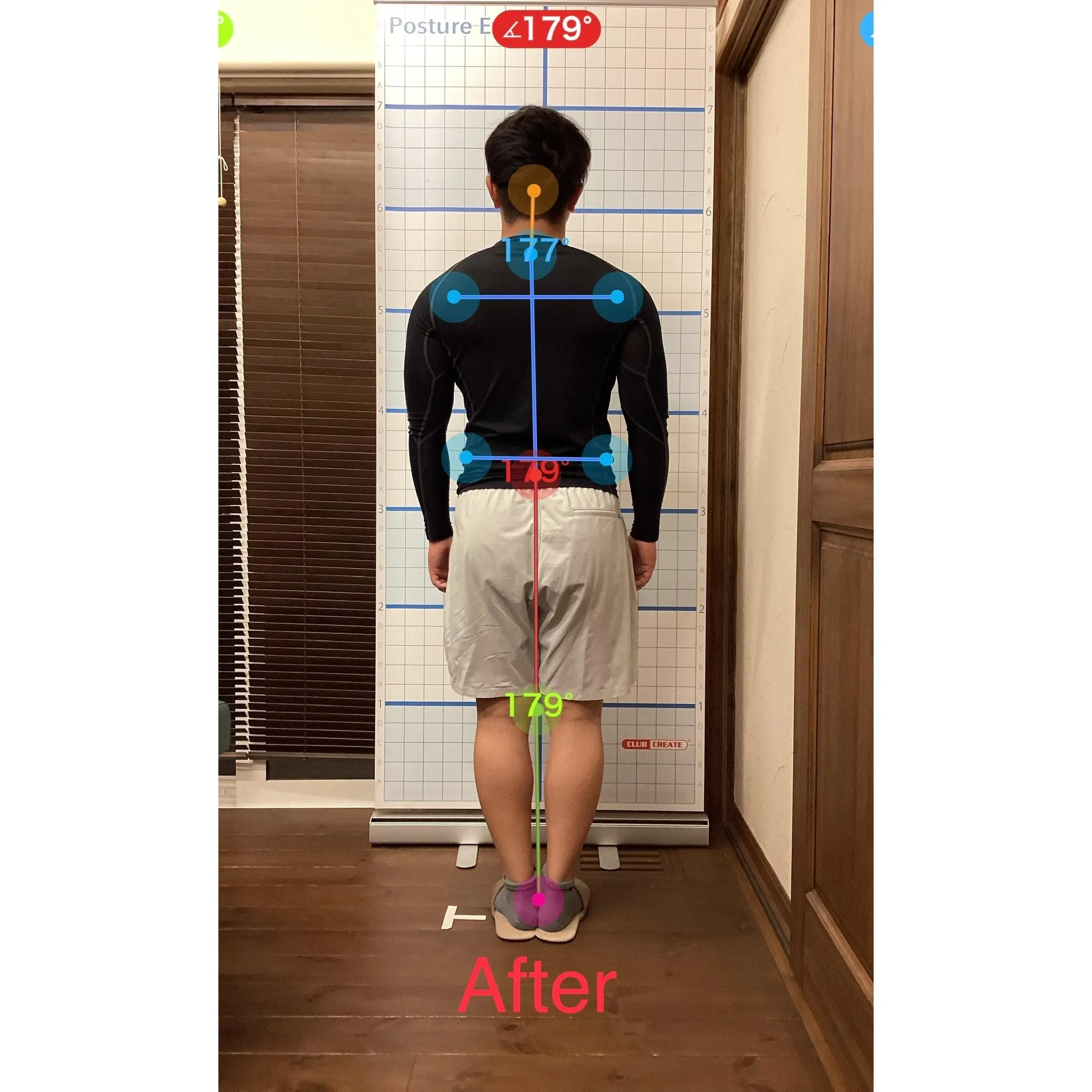 【富里 整体】首の痛み、頭痛、足底筋膜炎 他/20代男性/消...