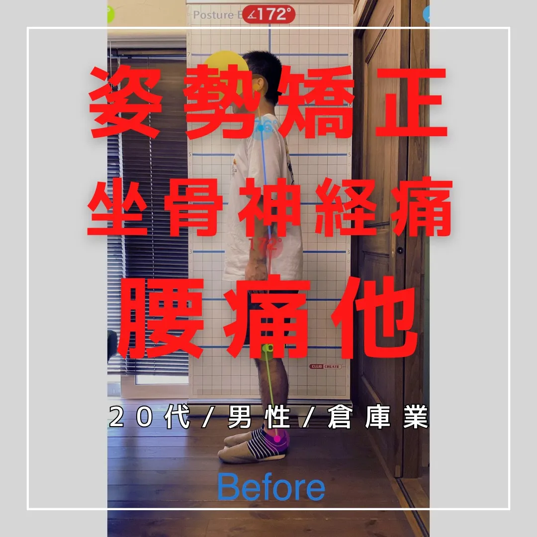 【富里 整体】腰痛、坐骨神経痛、姿勢矯正 他/20代男性/倉...