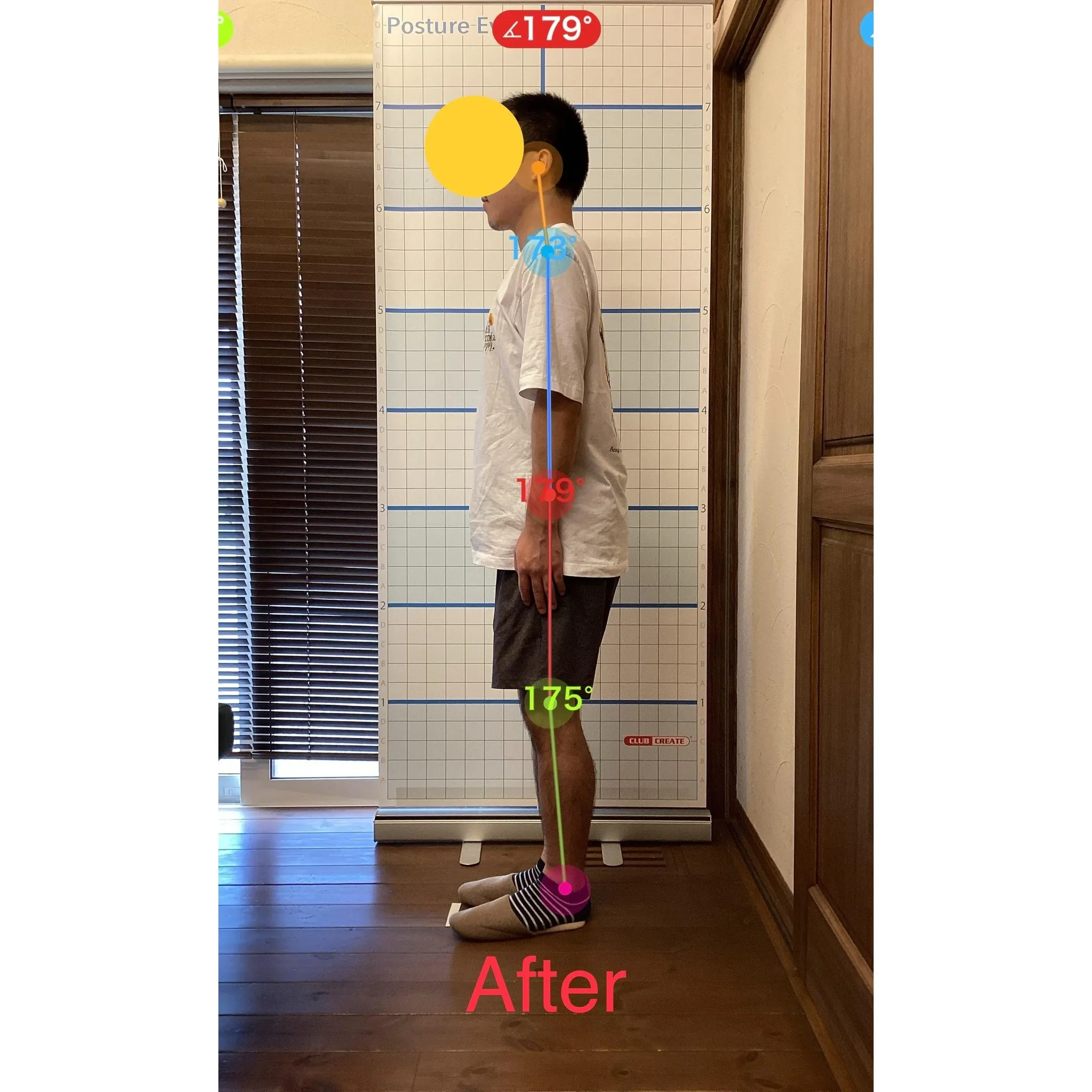 【富里 整体】腰痛、坐骨神経痛、姿勢矯正 他/20代男性/倉...