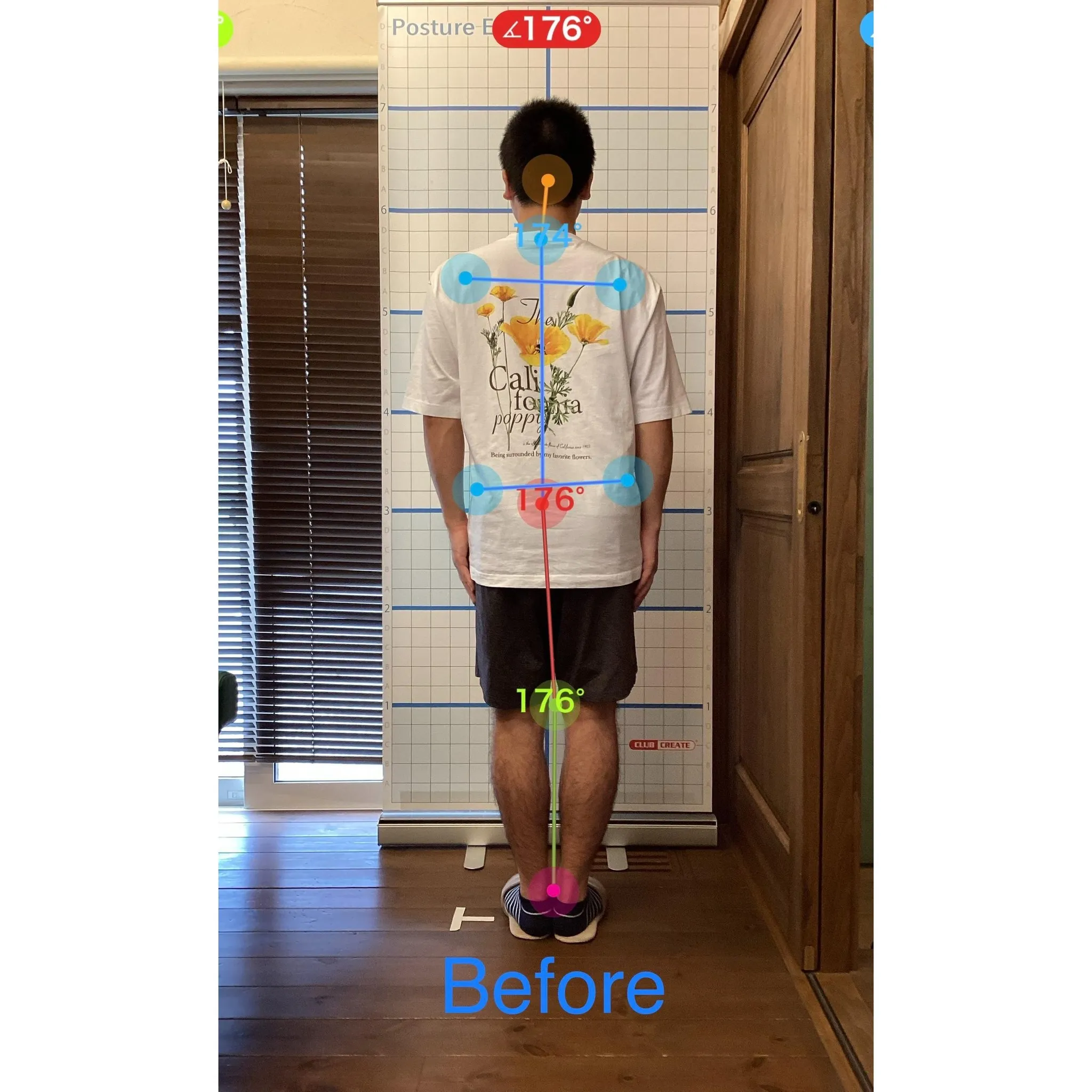 【富里 整体】腰痛、坐骨神経痛、姿勢矯正 他/20代男性/倉...