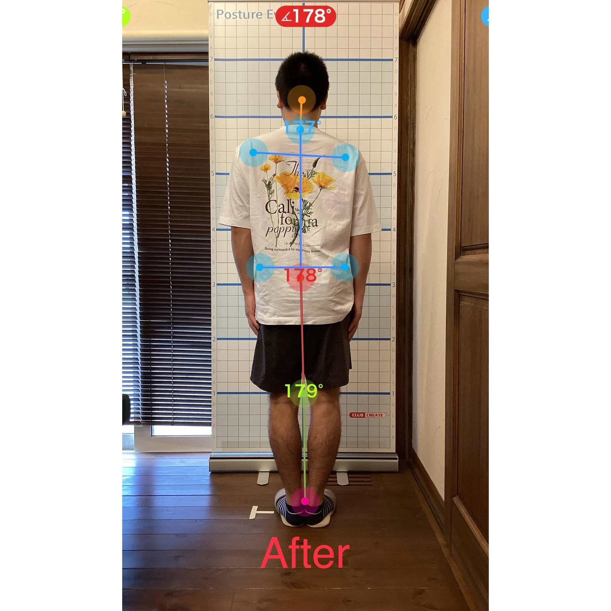 【富里 整体】腰痛、坐骨神経痛、姿勢矯正 他/20代男性/倉...