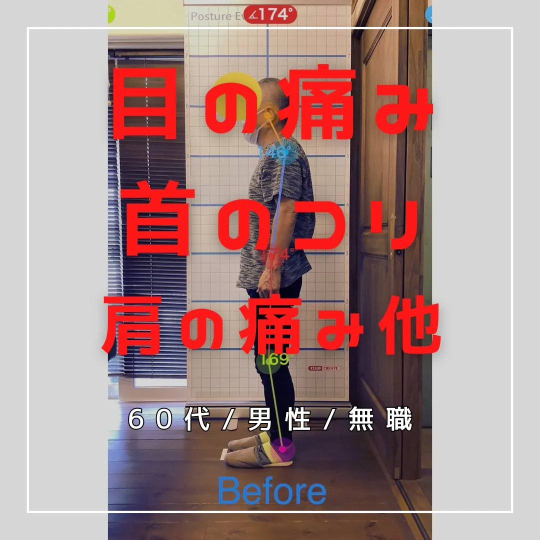 【富里 整体】首コリ、左肩の痛み、目の痛み 他/60代男性/...