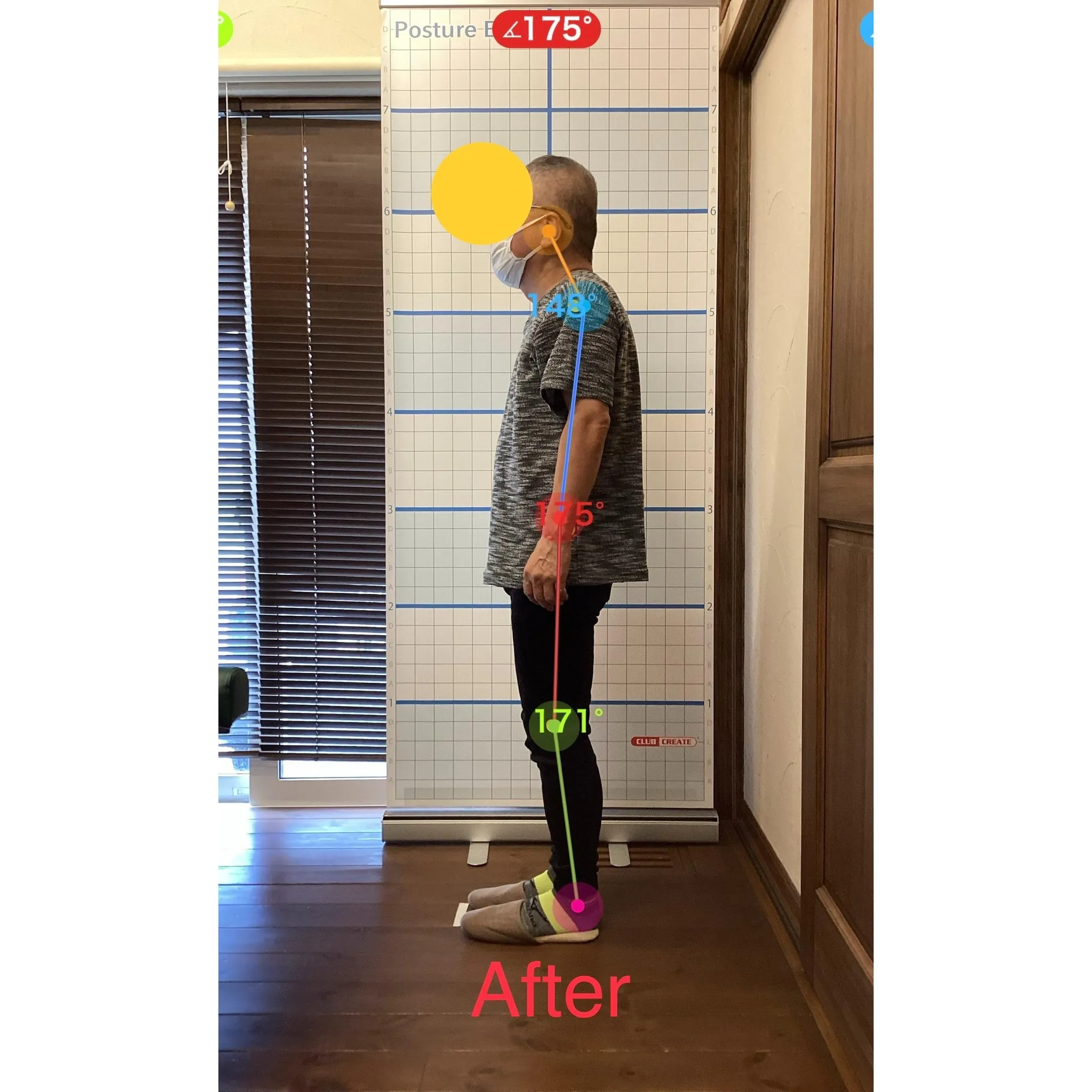 【富里 整体】首コリ、左肩の痛み、目の痛み 他/60代男性/...