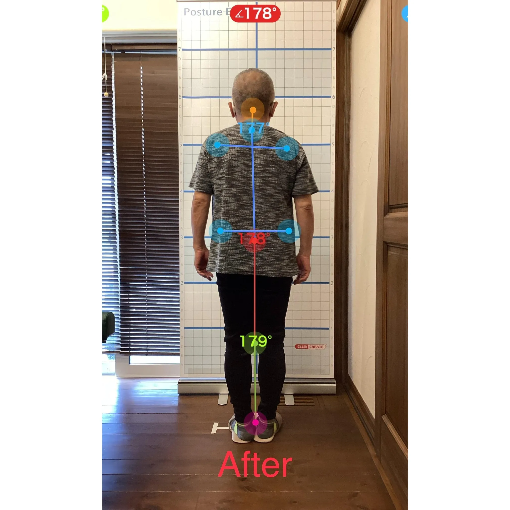 【富里 整体】首コリ、左肩の痛み、目の痛み 他/60代男性/...