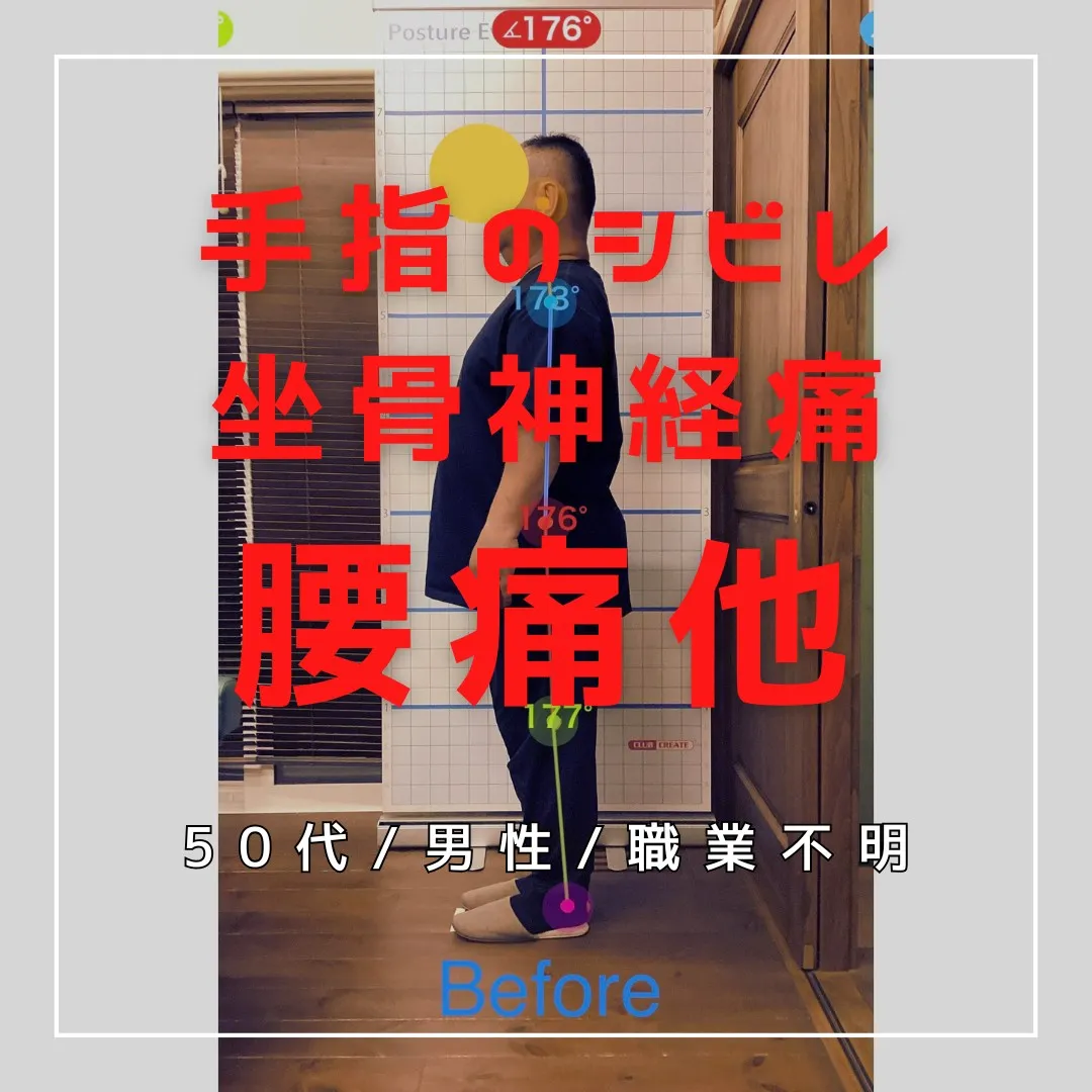 【富里 整体】腰痛、坐骨神経痛、左手指のシビレ（中指、薬指）...