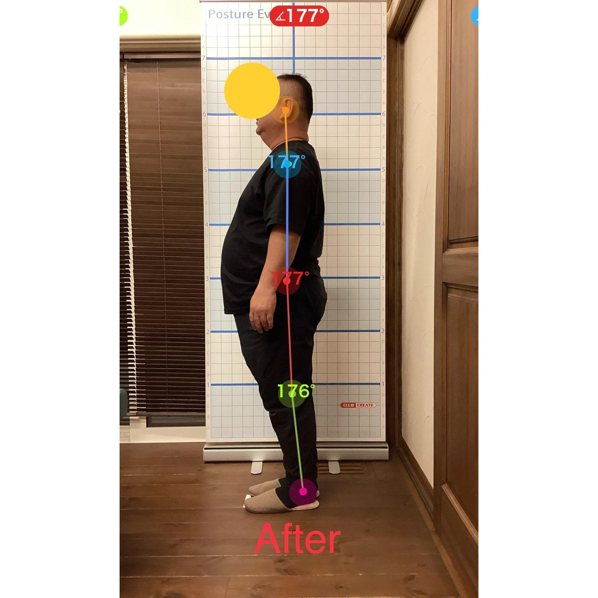 【富里 整体】腰痛、坐骨神経痛、左手指のシビレ（中指、薬指）...