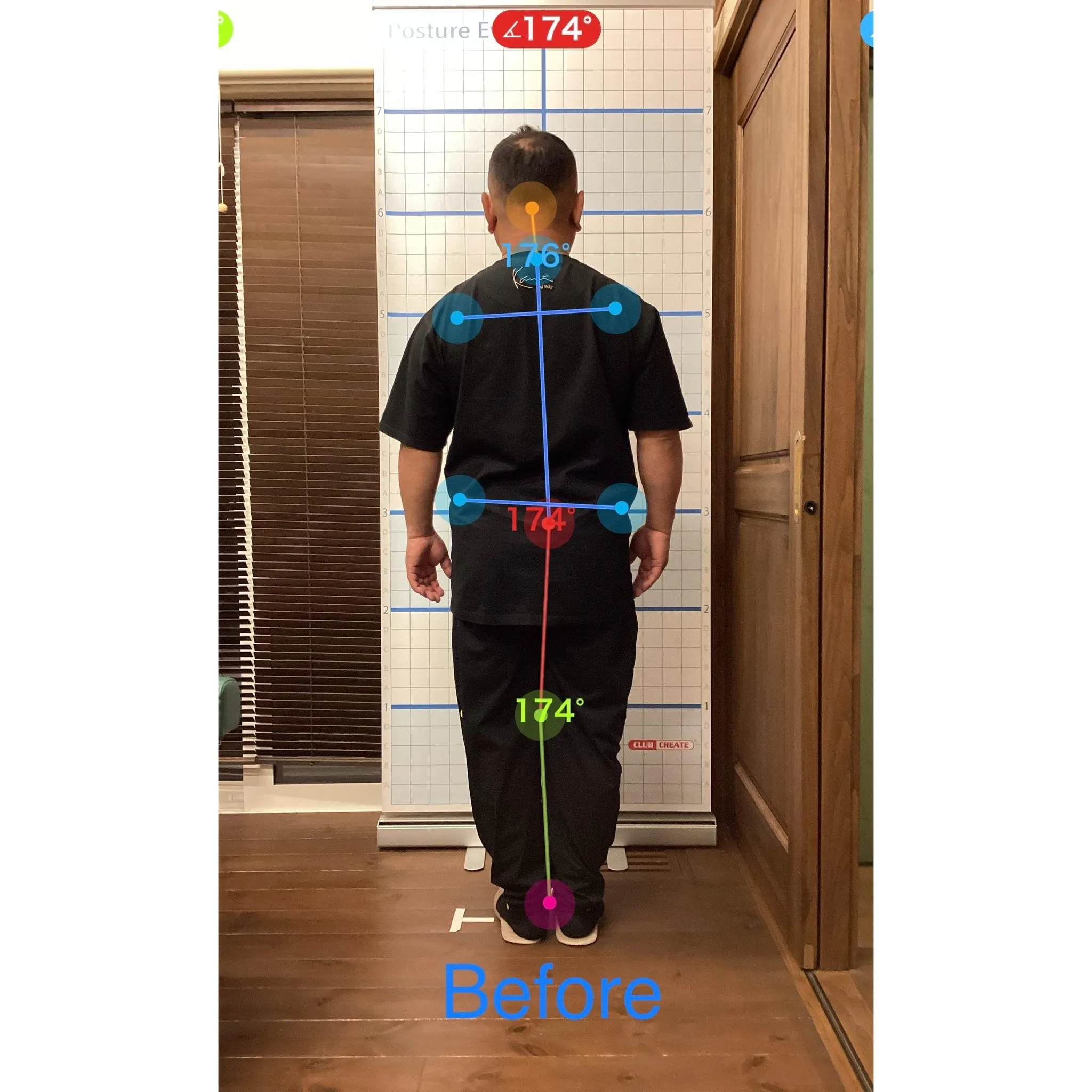 【富里 整体】腰痛、坐骨神経痛、左手指のシビレ（中指、薬指）...