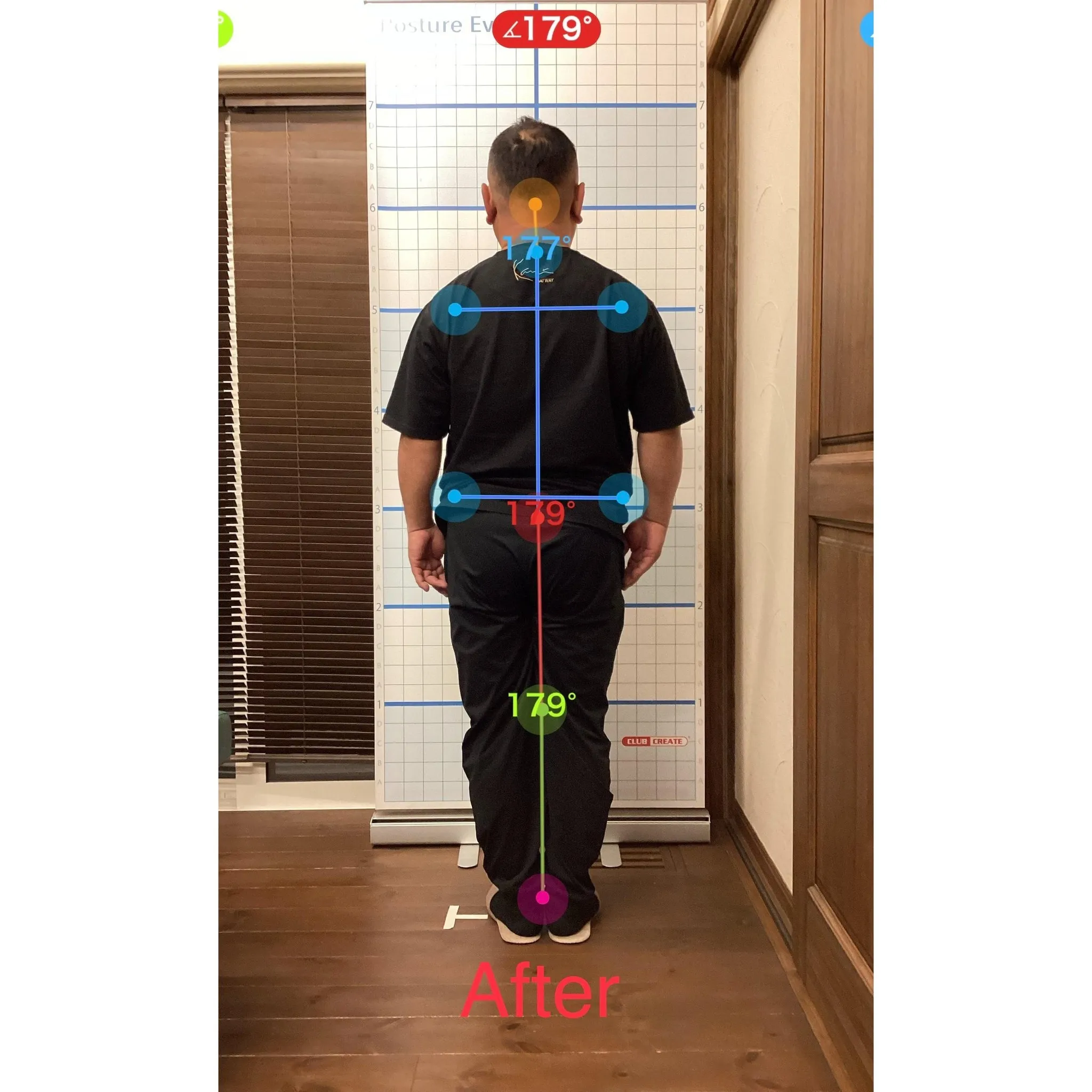 【富里 整体】腰痛、坐骨神経痛、左手指のシビレ（中指、薬指）...