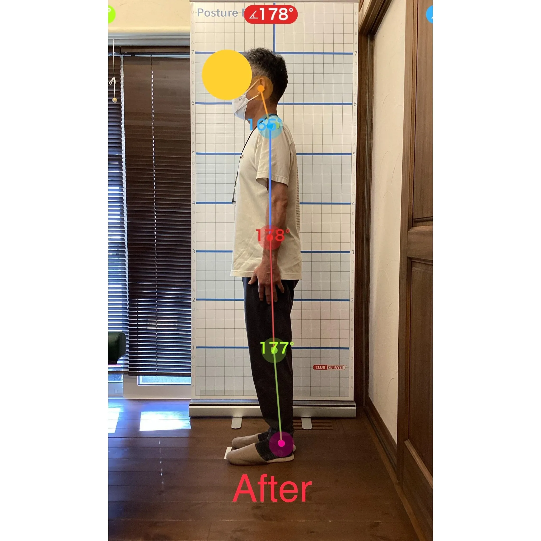 【富里 整体】慢性腰痛、ギックリ腰、耳鳴り/50代男性/鉄鋼...