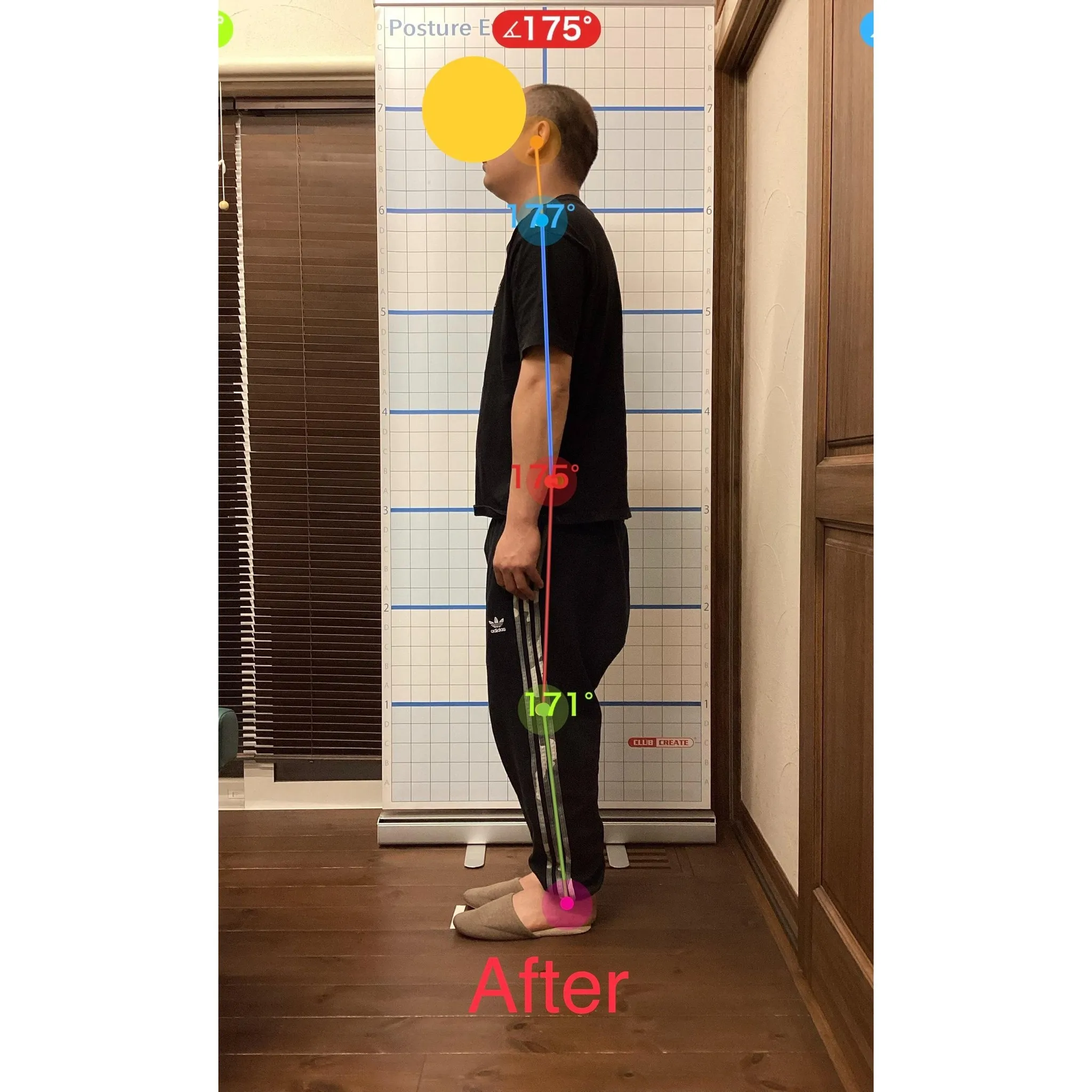 【富里 整体】臀部の痛み、腰痛、猫背 他/30代男性/倉庫業