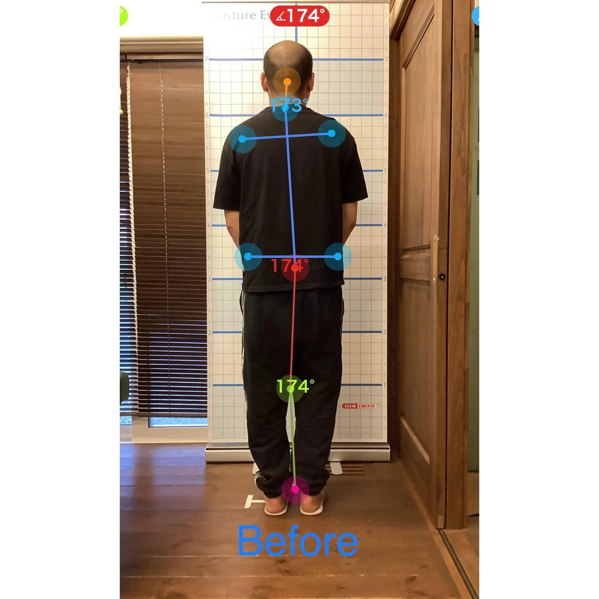 【富里 整体】臀部の痛み、腰痛、猫背 他/30代男性/倉庫業