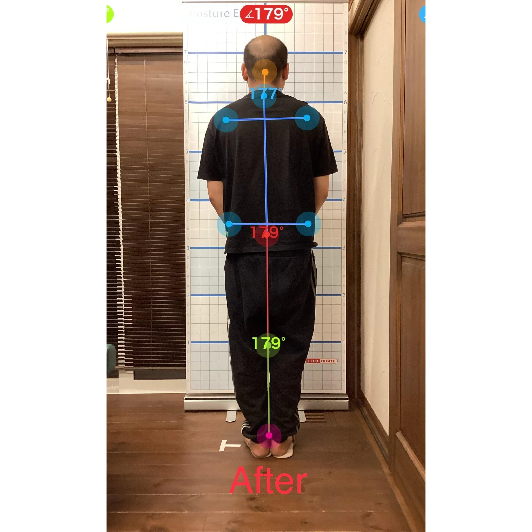 【富里 整体】臀部の痛み、腰痛、猫背 他/30代男性/倉庫業