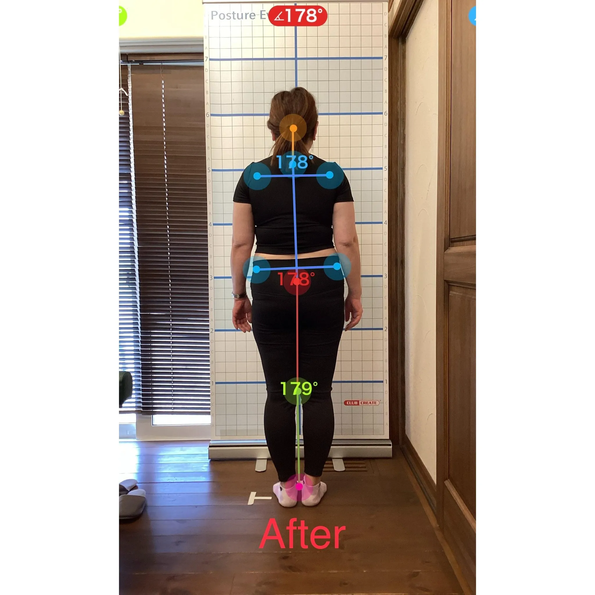 【富里 整体】腰痛、肩こり、頭痛 他/50代女性/パート