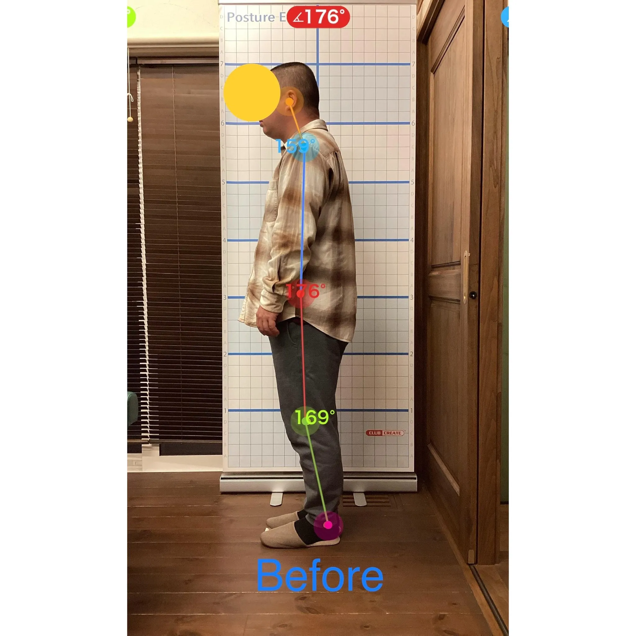 【富里 整体】首こり、肩こり、背中の痛み 他/30代男性/公...