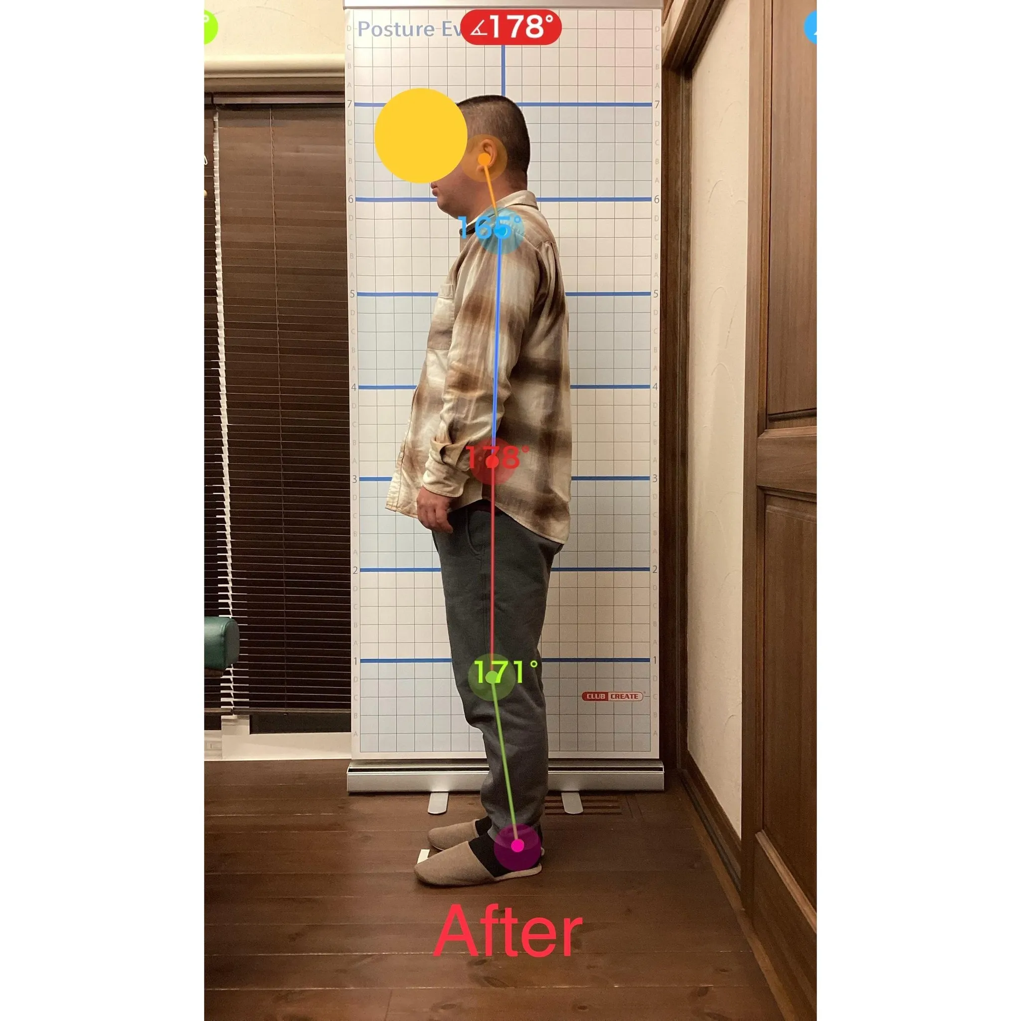 【富里 整体】首こり、肩こり、背中の痛み 他/30代男性/公...