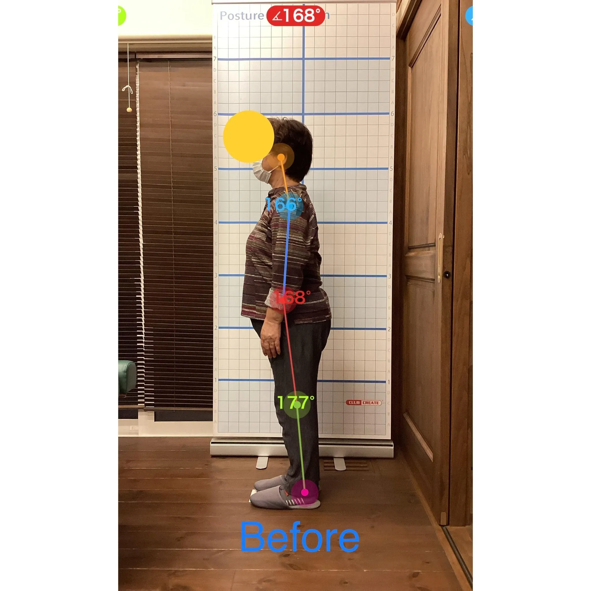 【富里 整体】腰椎ヘルニア、肩こり、脚の浮腫み 他/70代女...