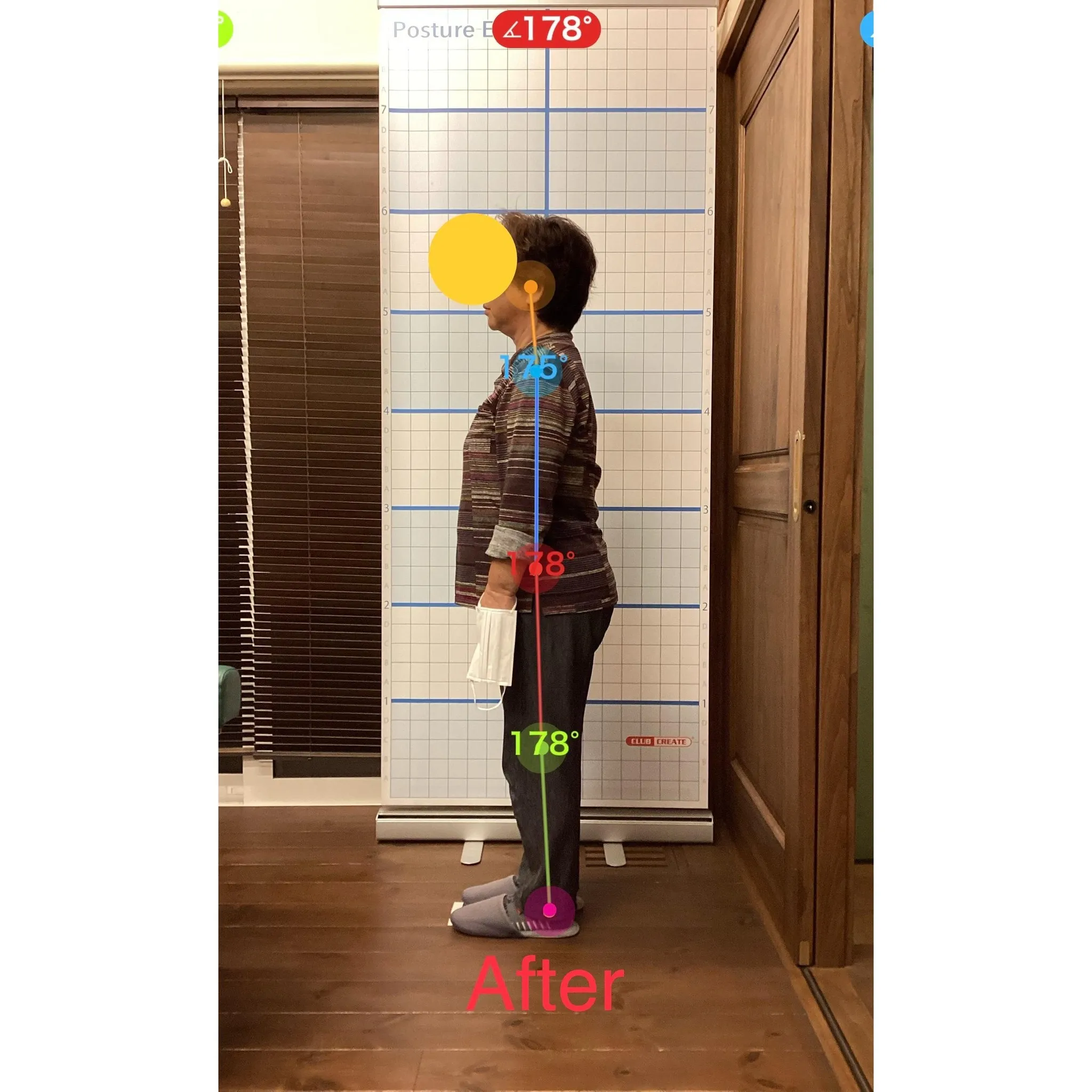 【富里 整体】腰椎ヘルニア、肩こり、脚の浮腫み 他/70代女...