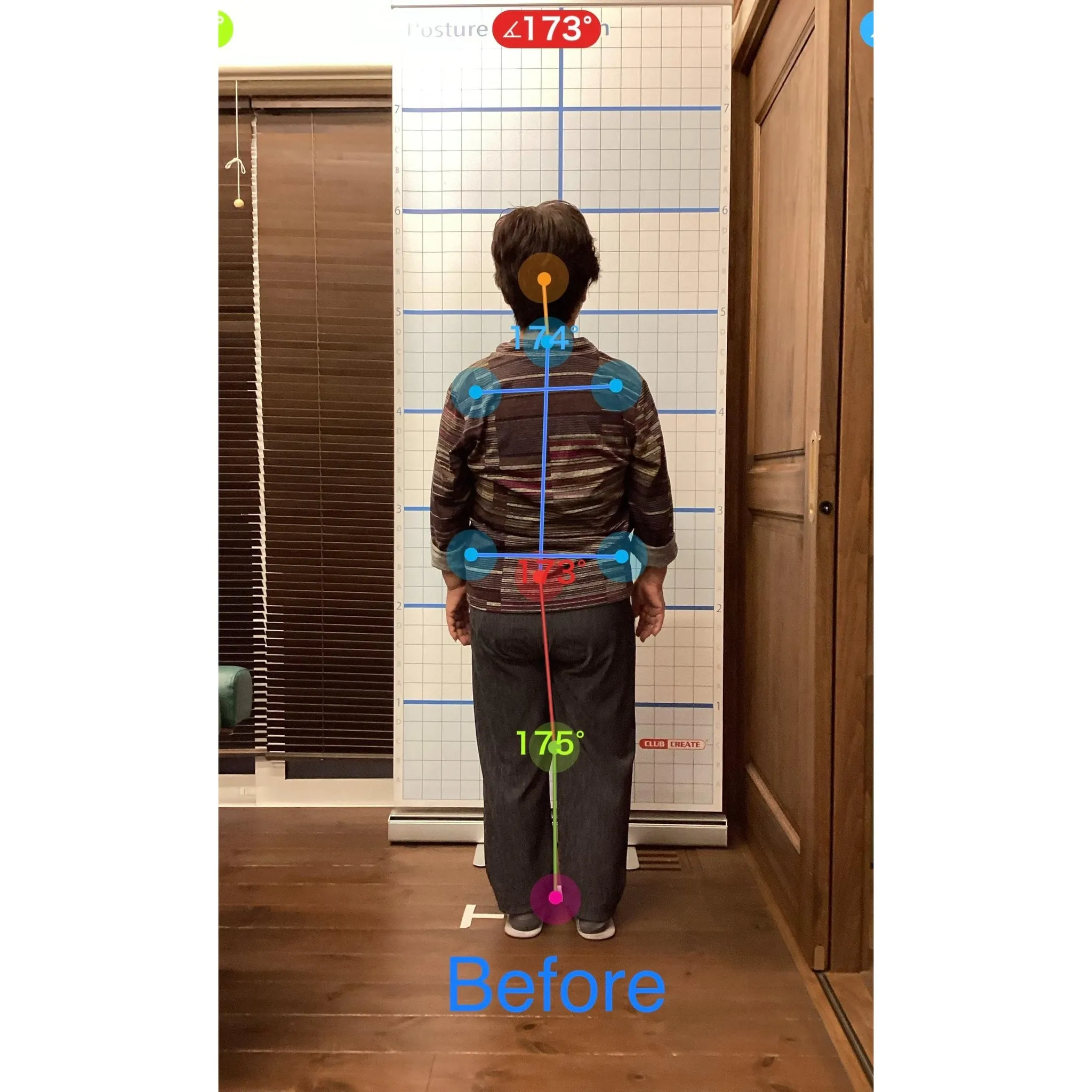 【富里 整体】腰椎ヘルニア、肩こり、脚の浮腫み 他/70代女...