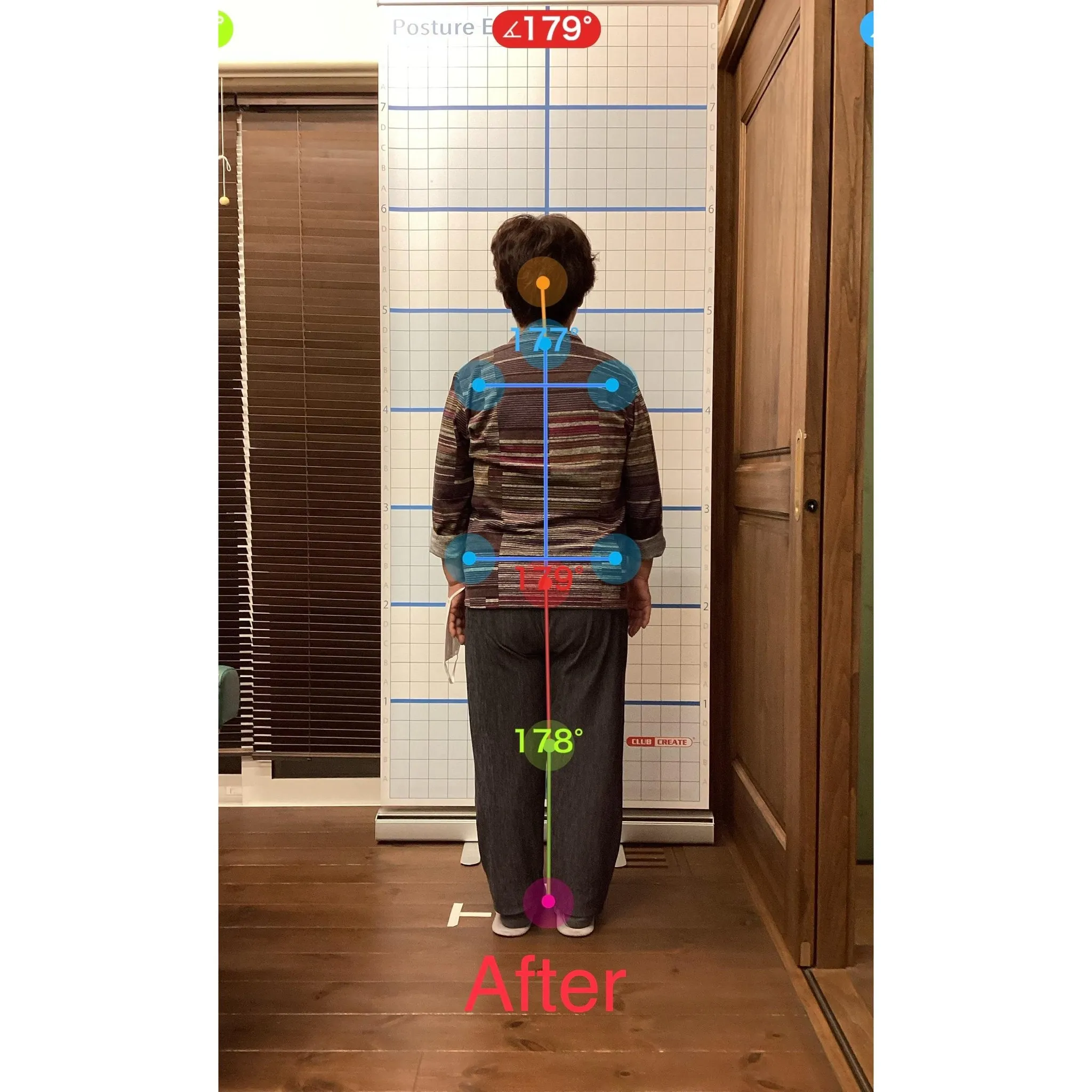 【富里 整体】腰椎ヘルニア、肩こり、脚の浮腫み 他/70代女...