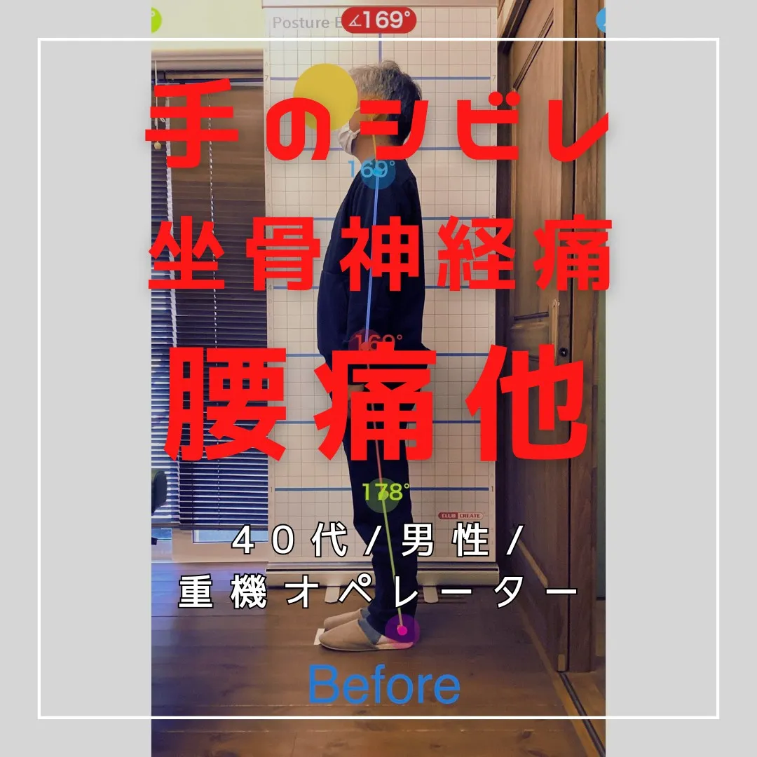 【富里 整体】腰痛、坐骨神経痛、手のシビレ 他/40代男性/...