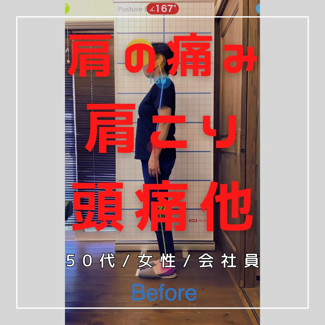 【富里 整体】肩の痛み、肩こり、頭痛 他/50代女性/会社員