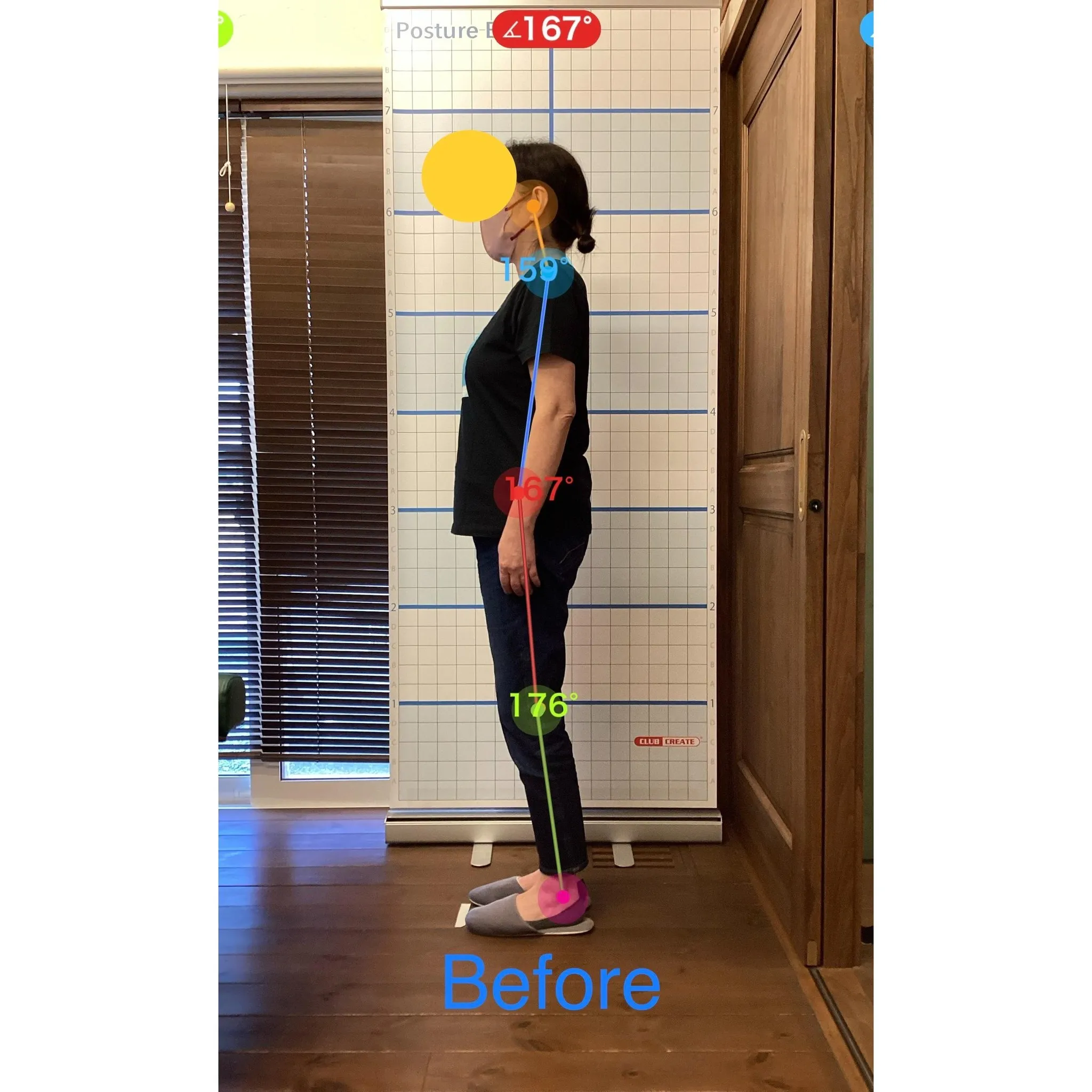 【富里 整体】肩の痛み、肩こり、頭痛 他/50代女性/会社員