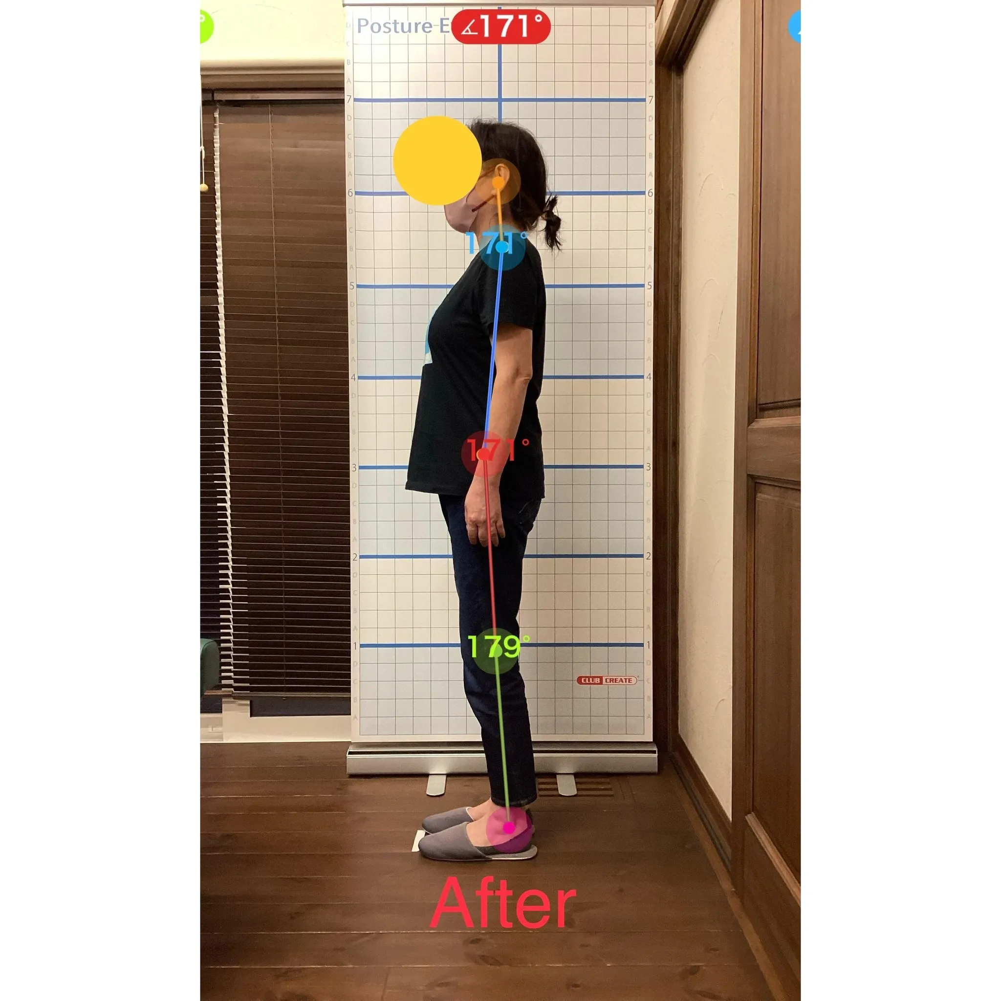 【富里 整体】肩の痛み、肩こり、頭痛 他/50代女性/会社員