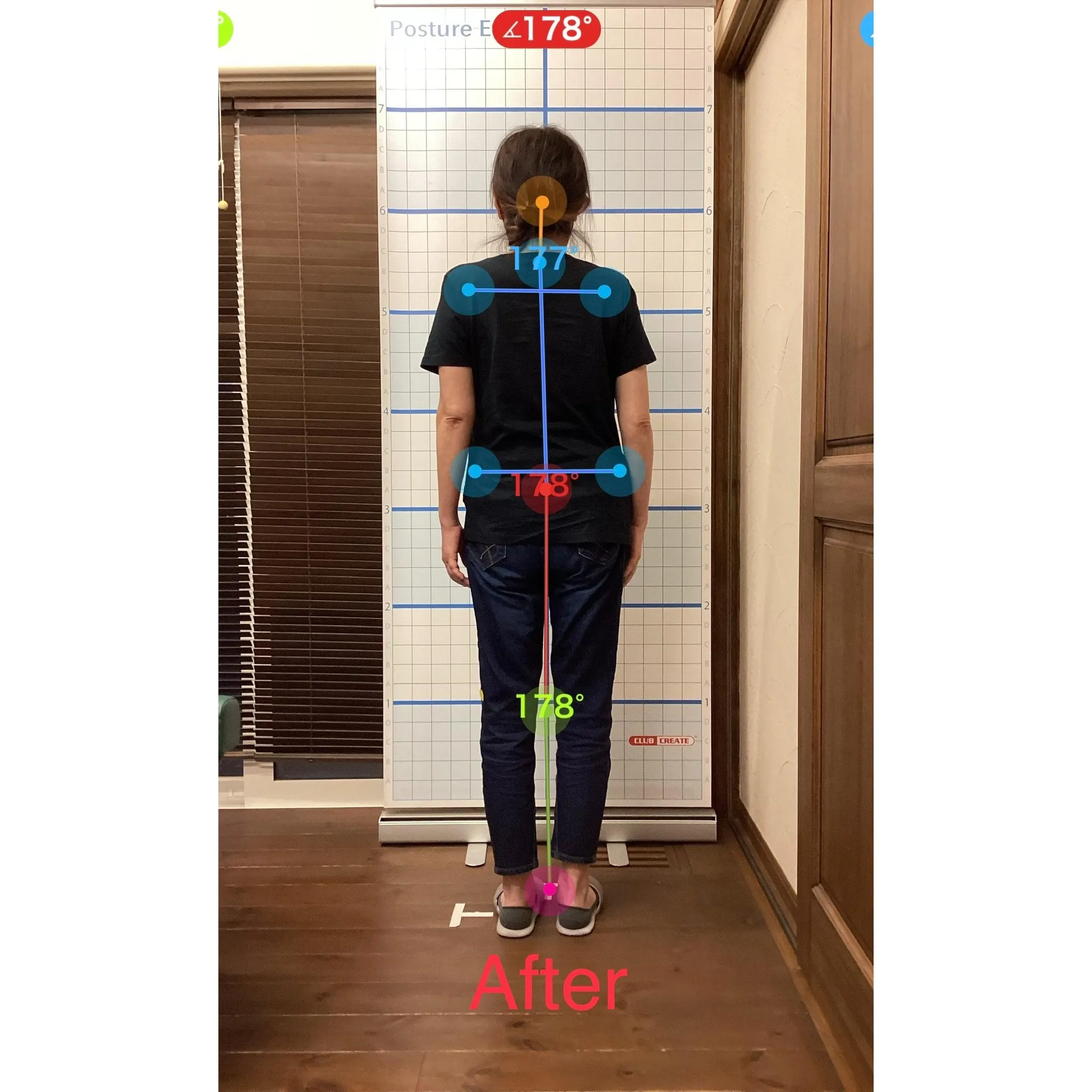 【富里 整体】肩の痛み、肩こり、頭痛 他/50代女性/会社員