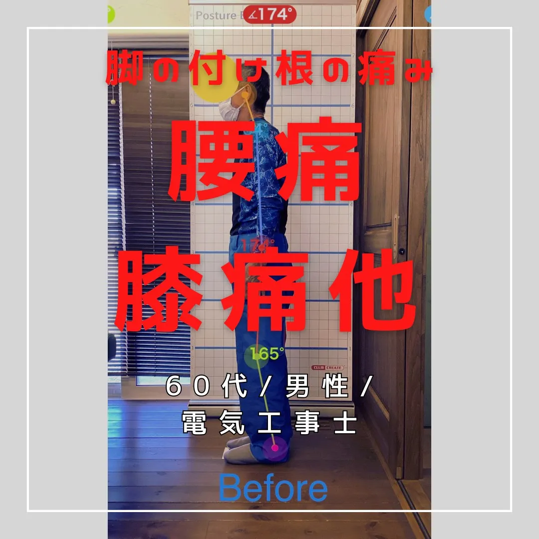 【富里 整体】腰痛、脚の付け根の痛み、膝痛 他/60代男性/...