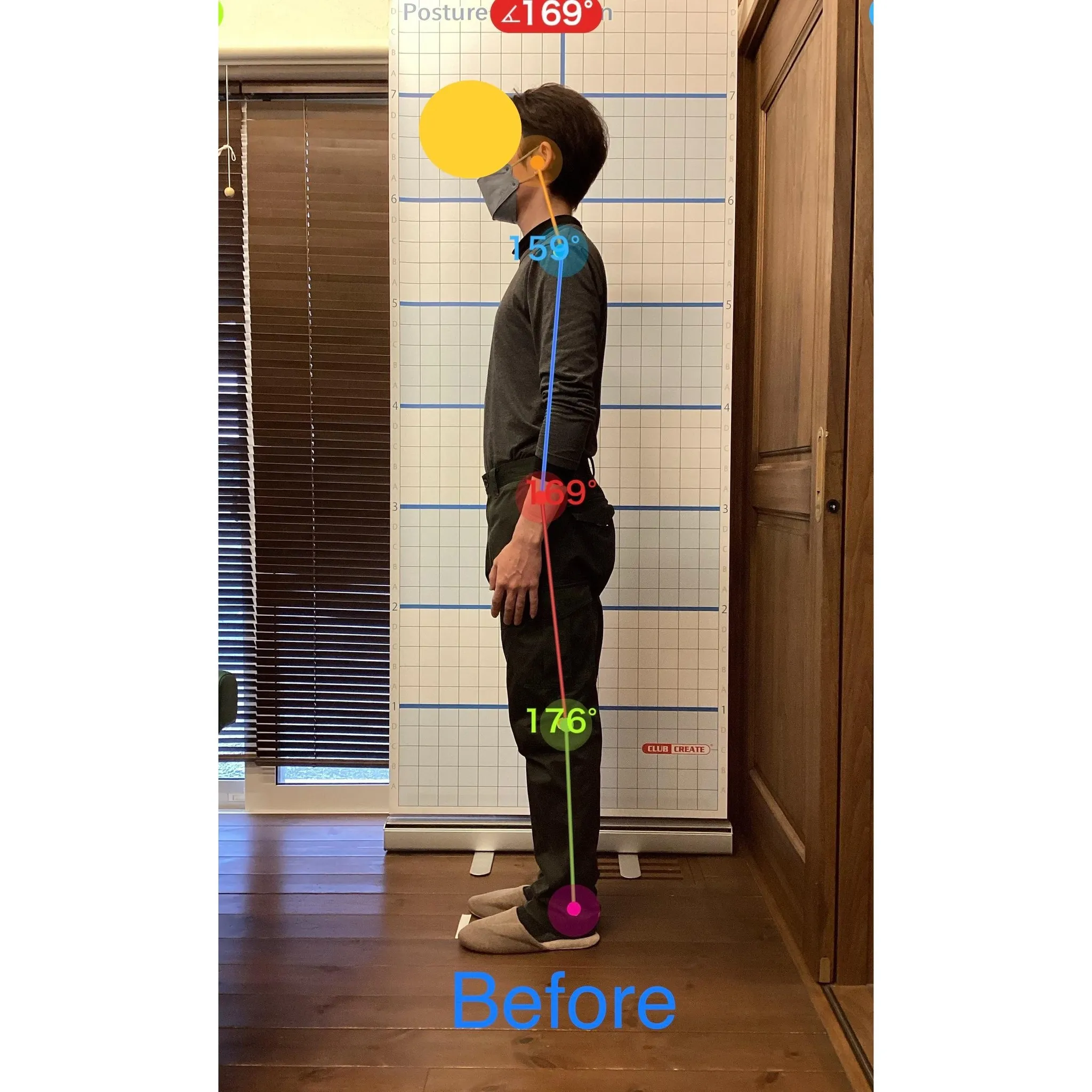 【富里 整体】首の痛み、頭痛、坐骨神経痛 他/30代男性/溶...