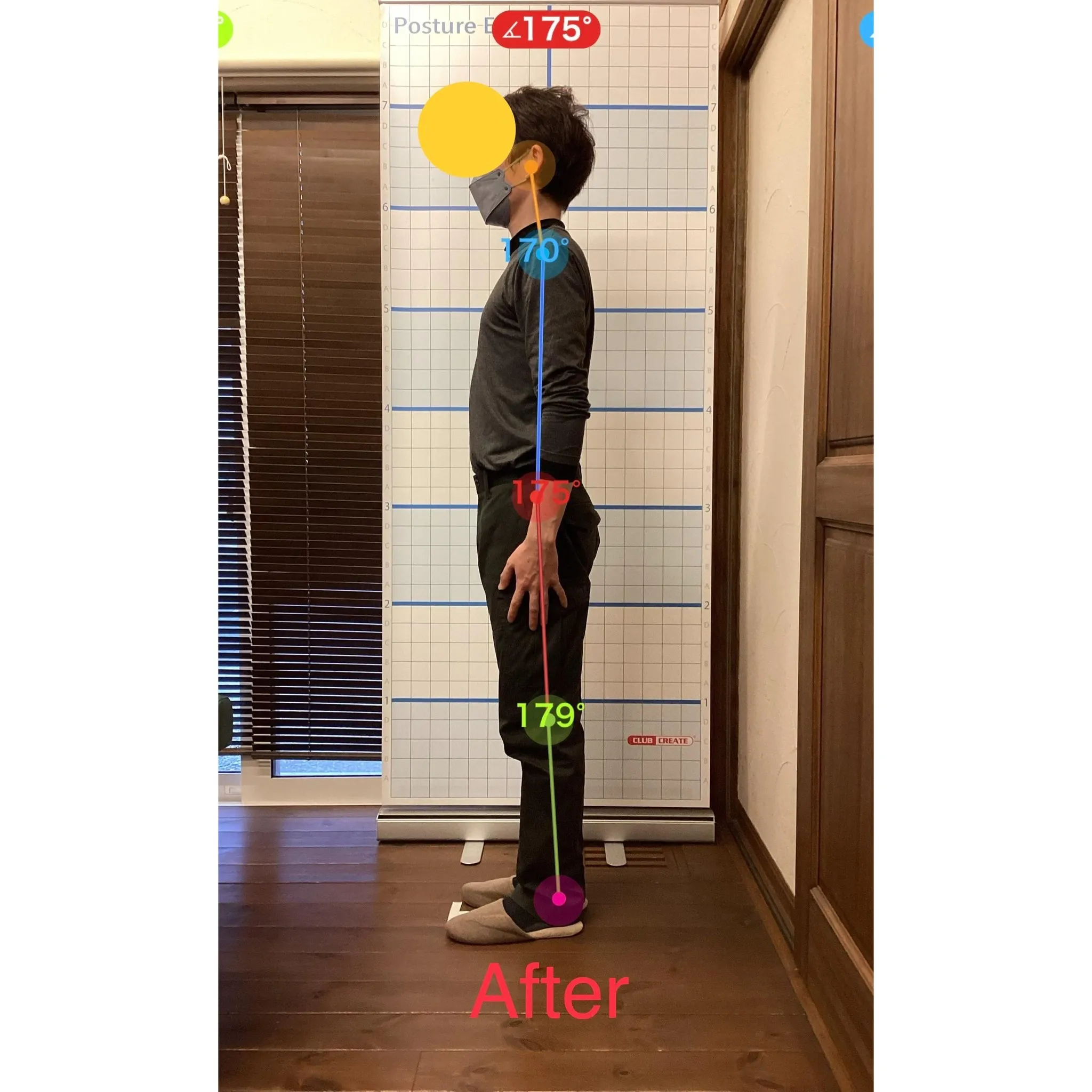 【富里 整体】首の痛み、頭痛、坐骨神経痛 他/30代男性/溶...