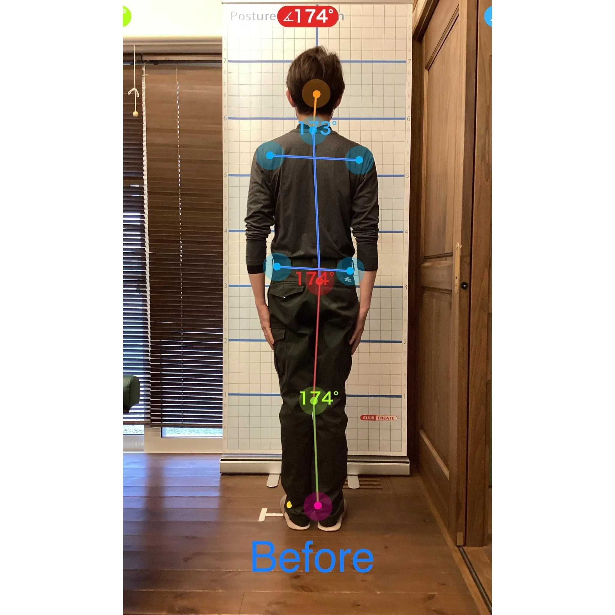 【富里 整体】首の痛み、頭痛、坐骨神経痛 他/30代男性/溶...