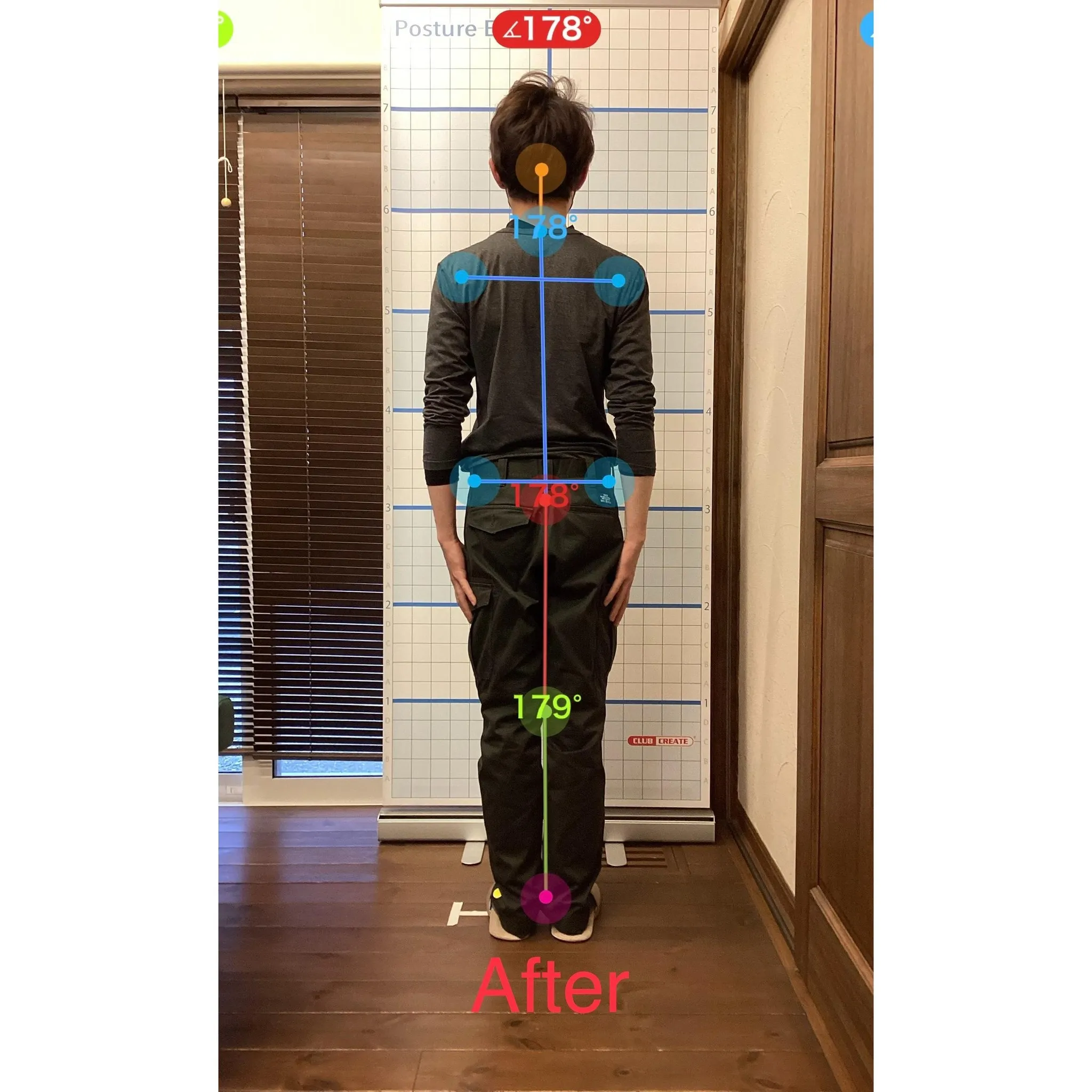 【富里 整体】首の痛み、頭痛、坐骨神経痛 他/30代男性/溶...