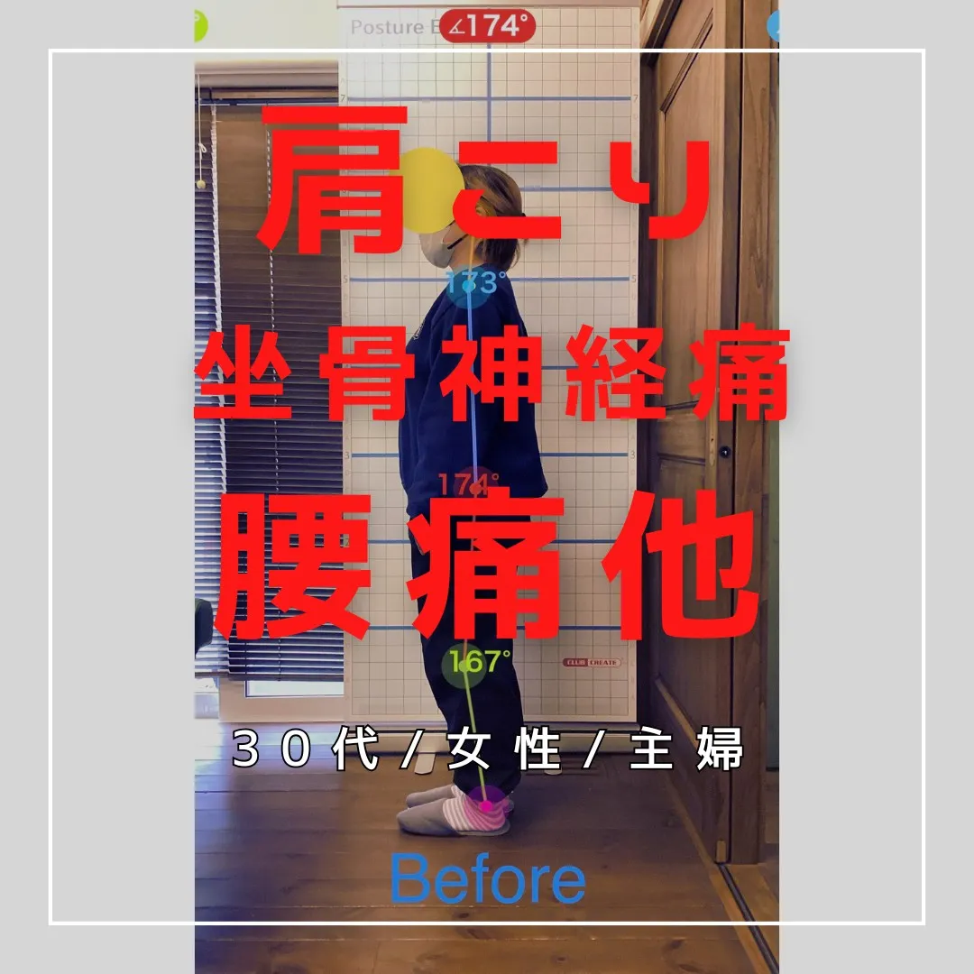 【富里 整体】坐骨神経痛、腰痛、肩こり 他/30代女性/主婦