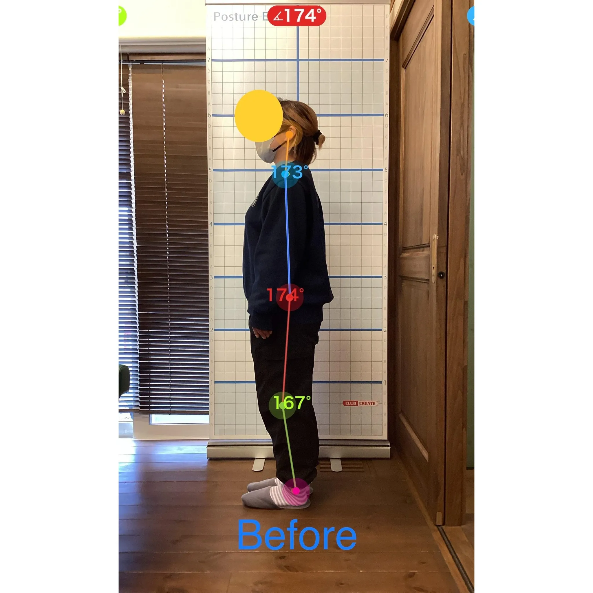 【富里 整体】坐骨神経痛、腰痛、肩こり 他/30代女性/主婦