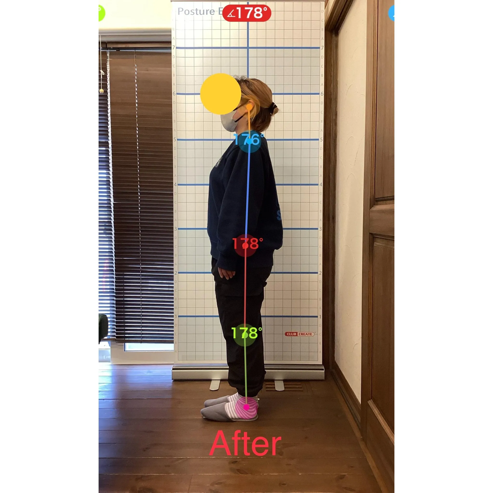 【富里 整体】坐骨神経痛、腰痛、肩こり 他/30代女性/主婦