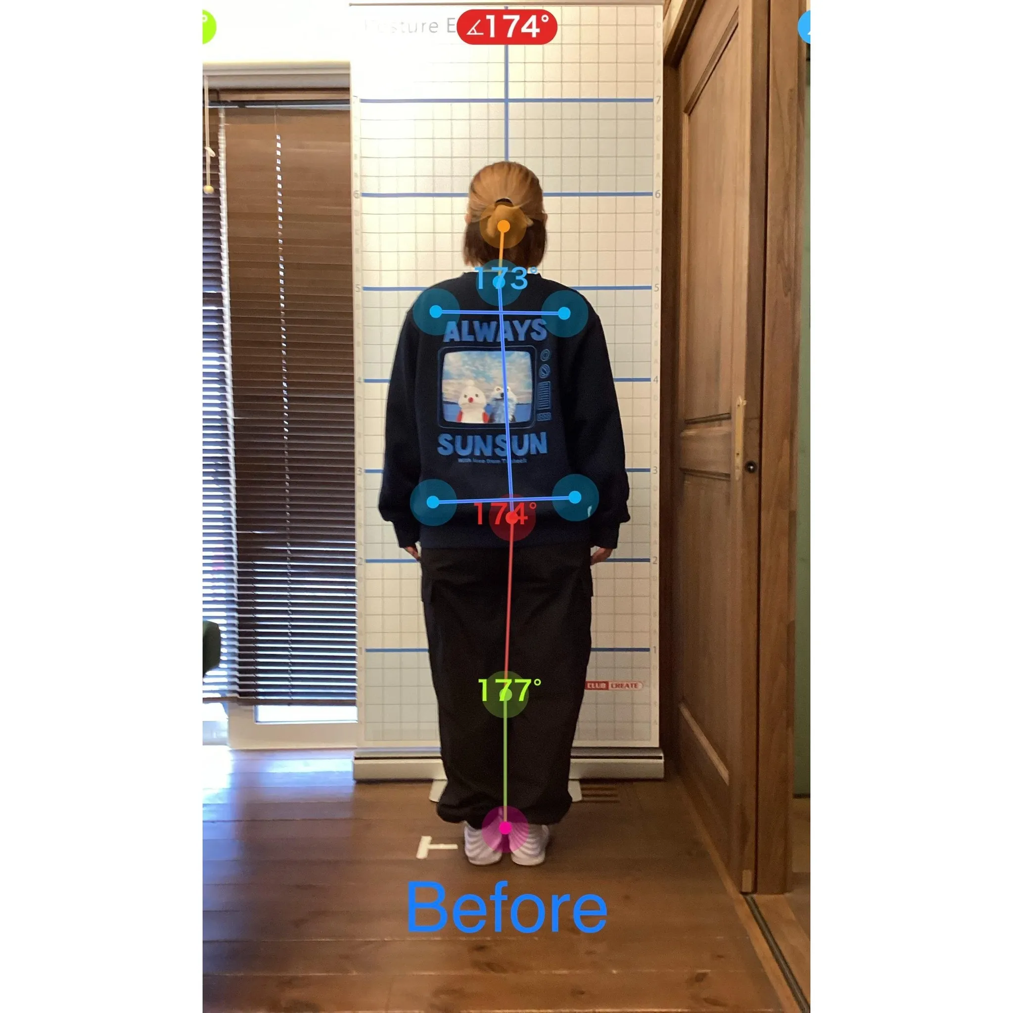 【富里 整体】坐骨神経痛、腰痛、肩こり 他/30代女性/主婦